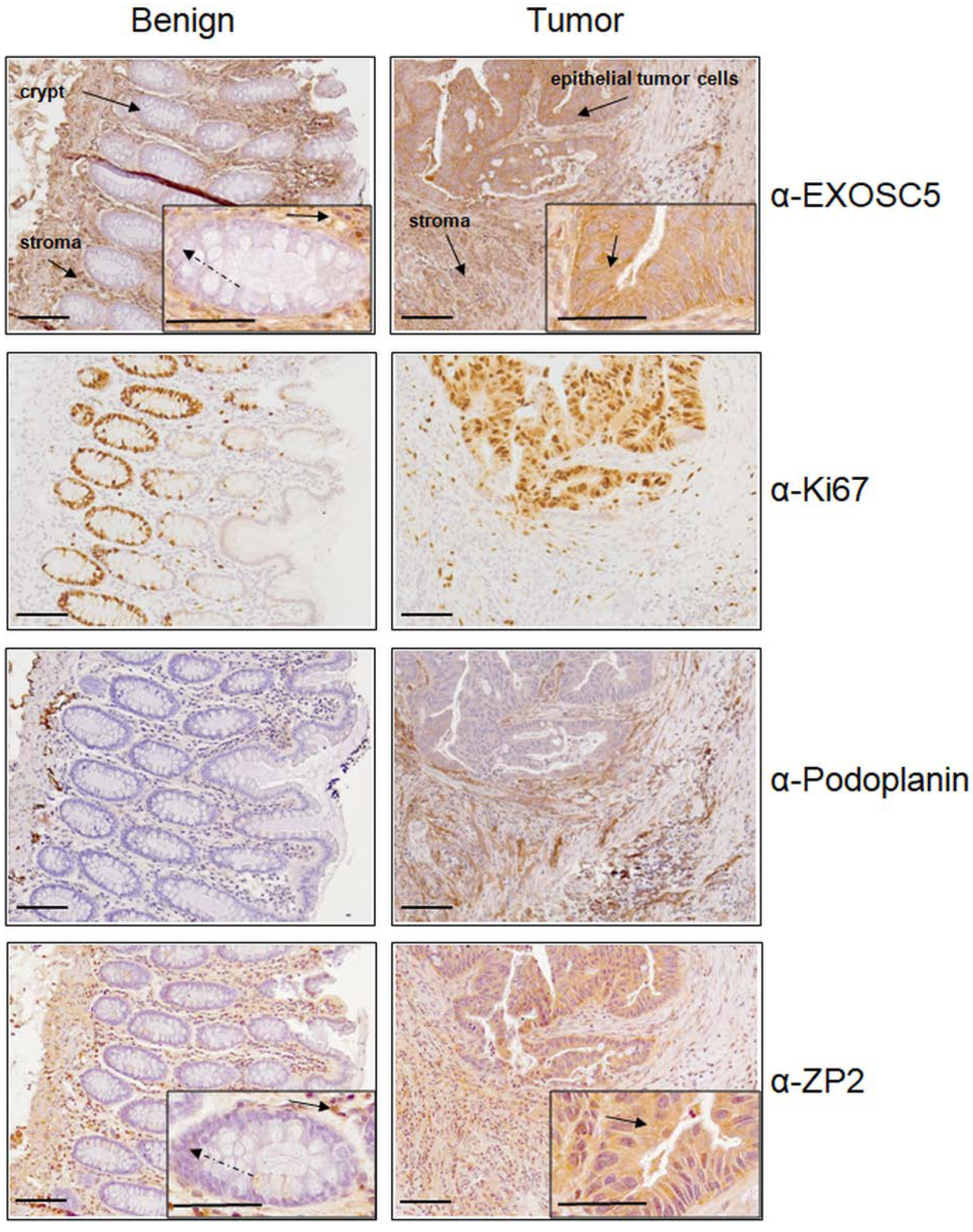 Cancers 13 01759 g005