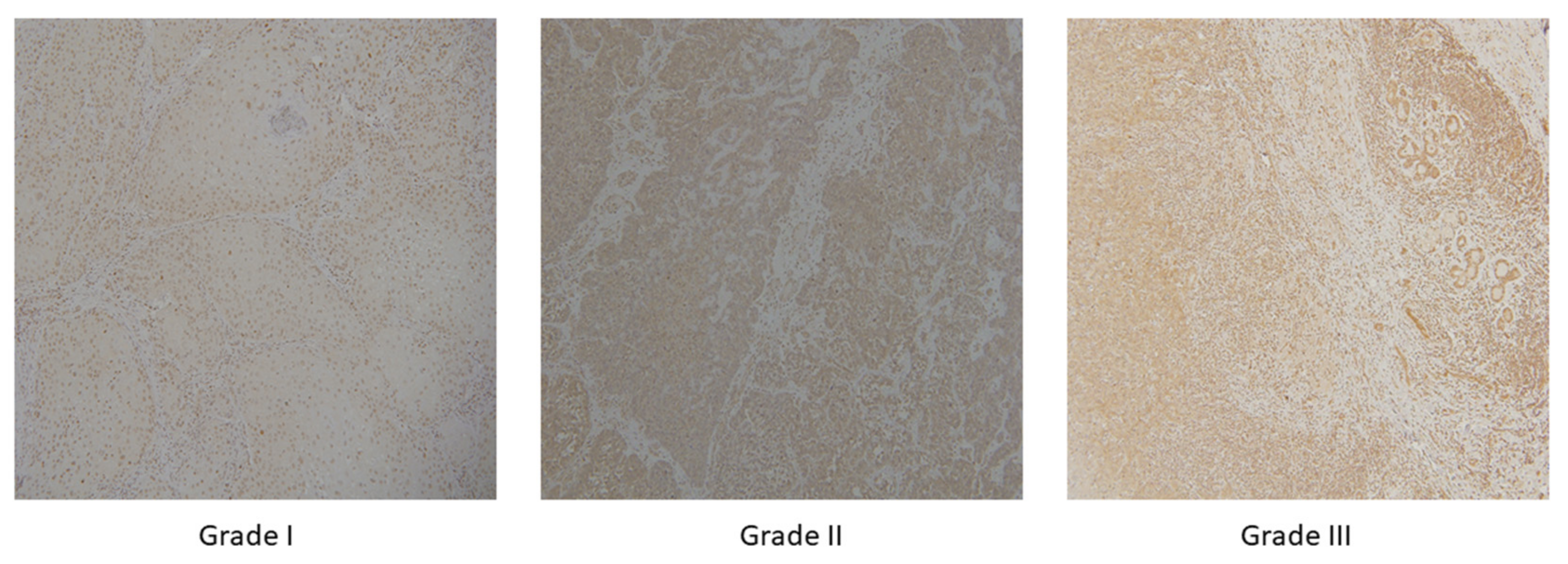 Cancers 13 01784 g002 Cancers 13 01784 g002