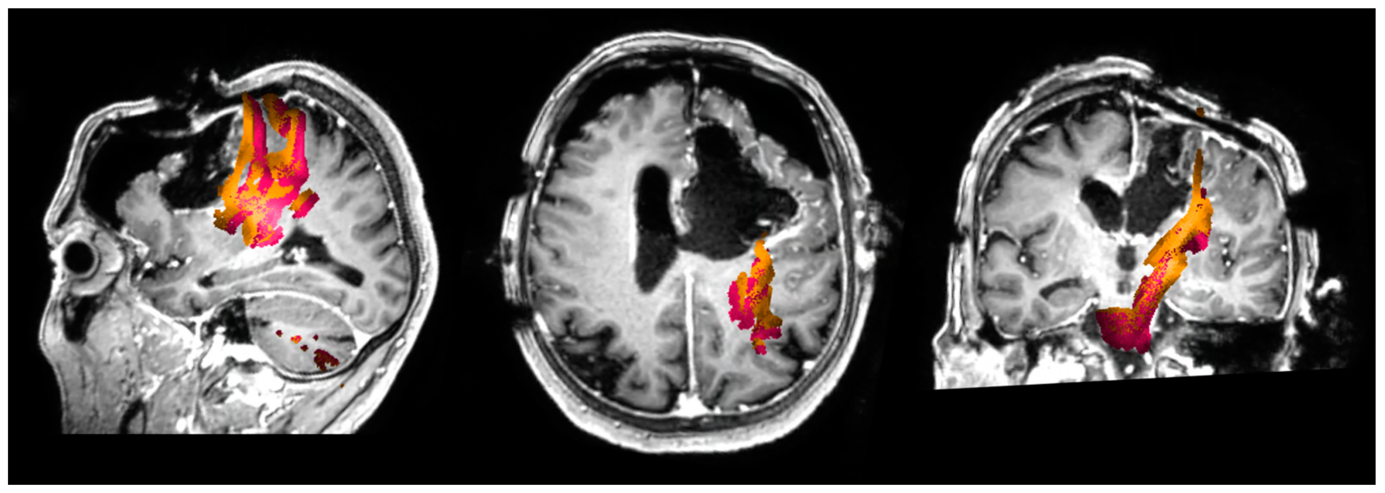 Cancers 13 01787 g001 Cancers 13 01787 g001