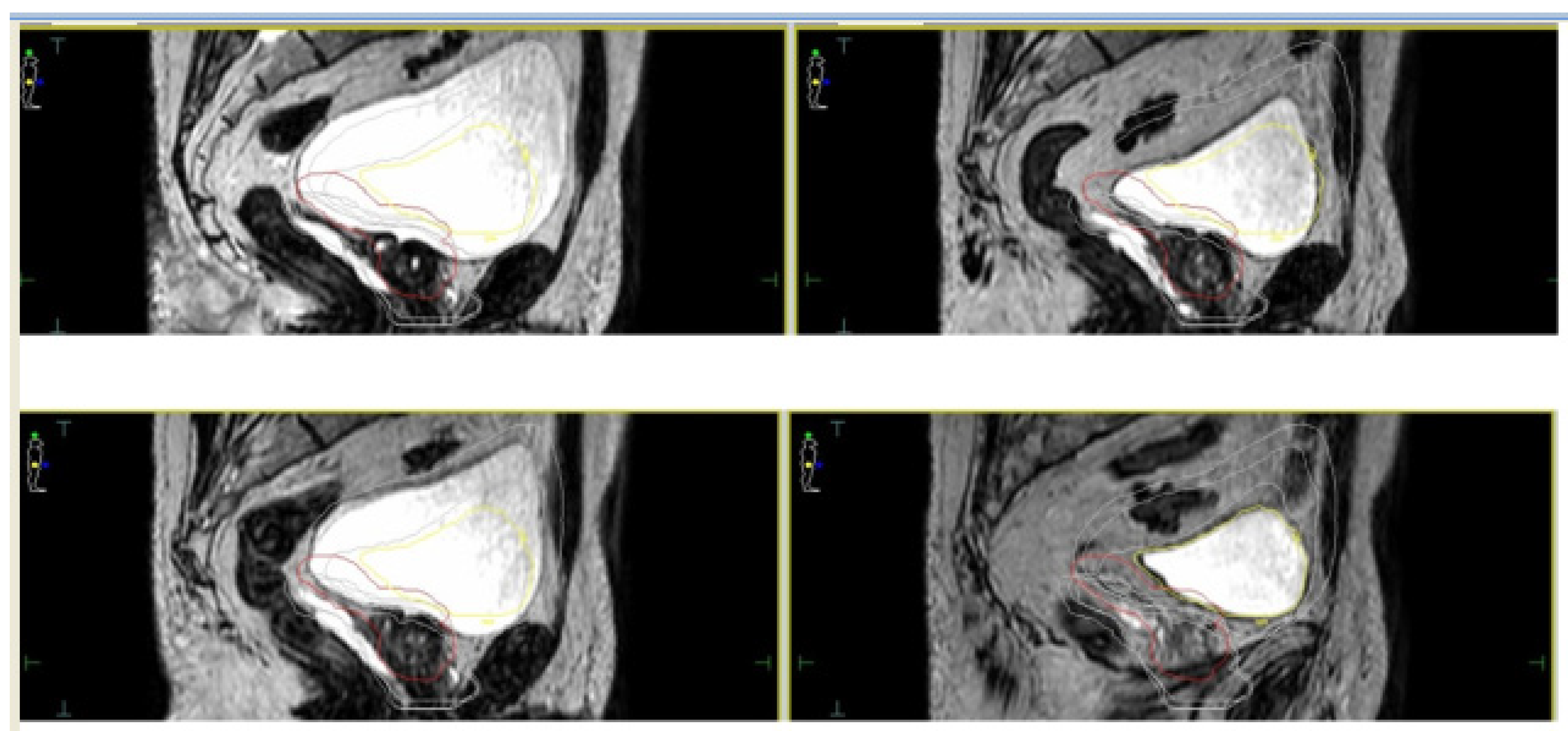 Cancers 13 01791 g002 Cancers 13 01791 g002