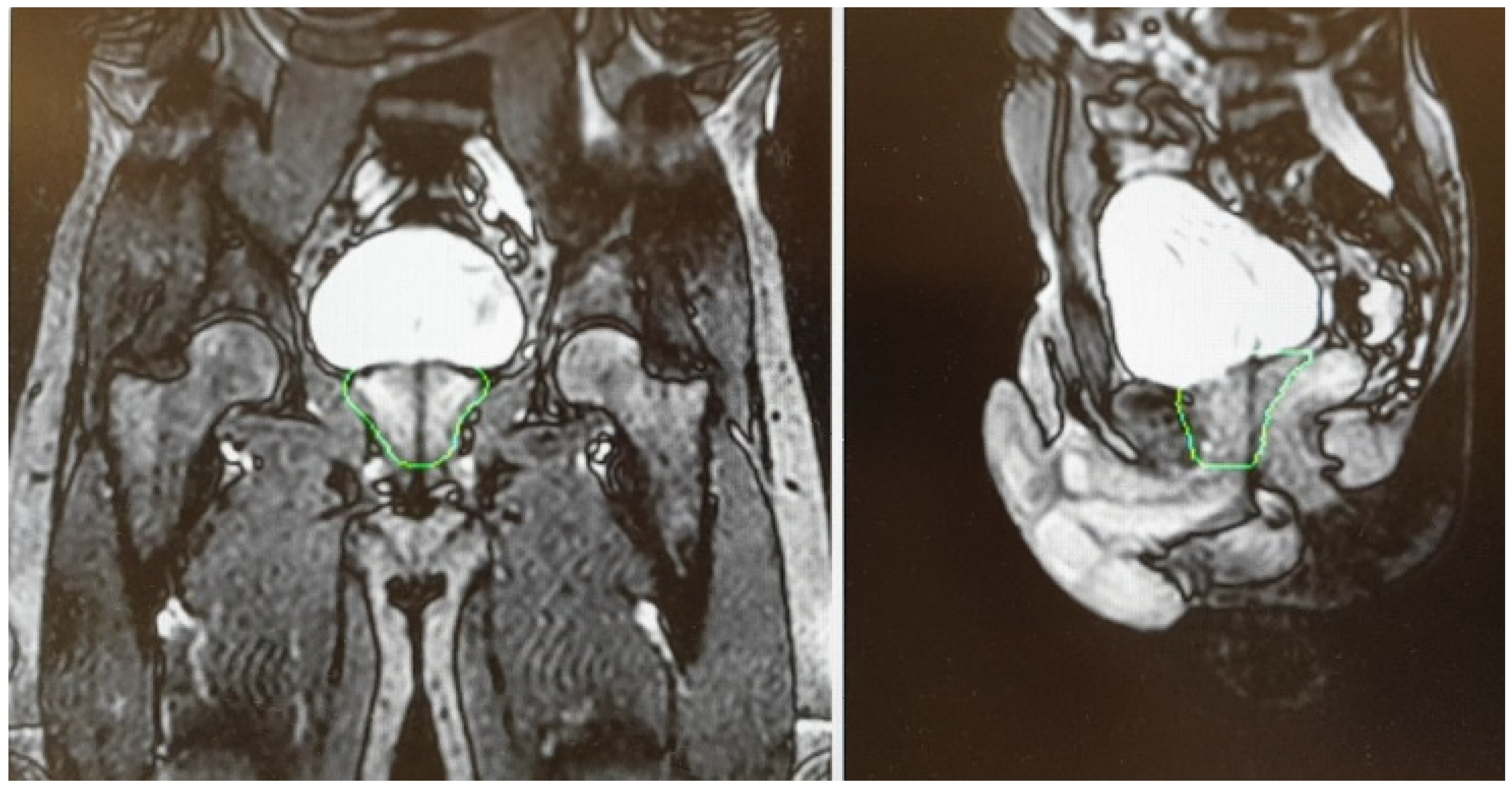 Cancers 13 01791 g003 Cancers 13 01791 g003