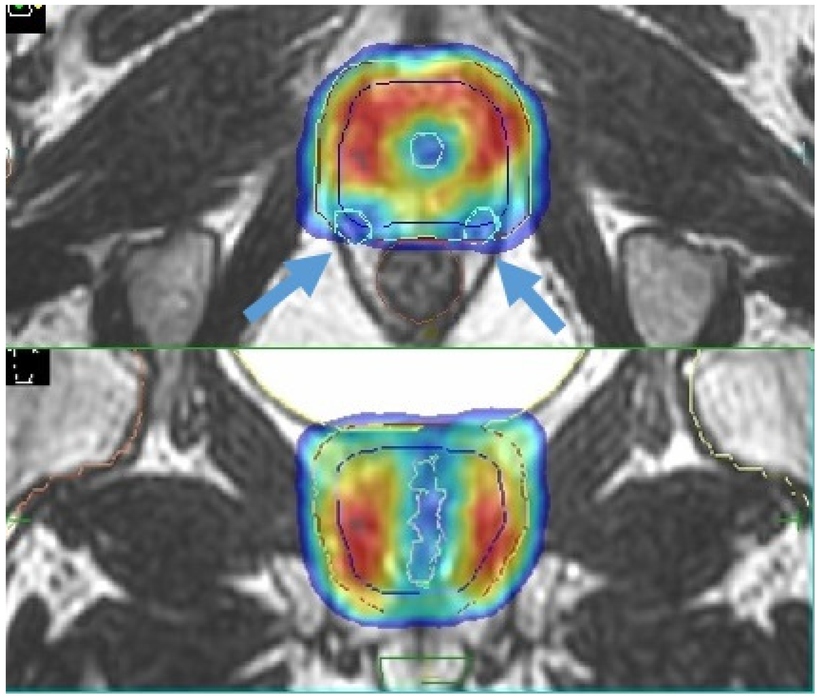 Cancers 13 01791 g004 Cancers 13 01791 g004