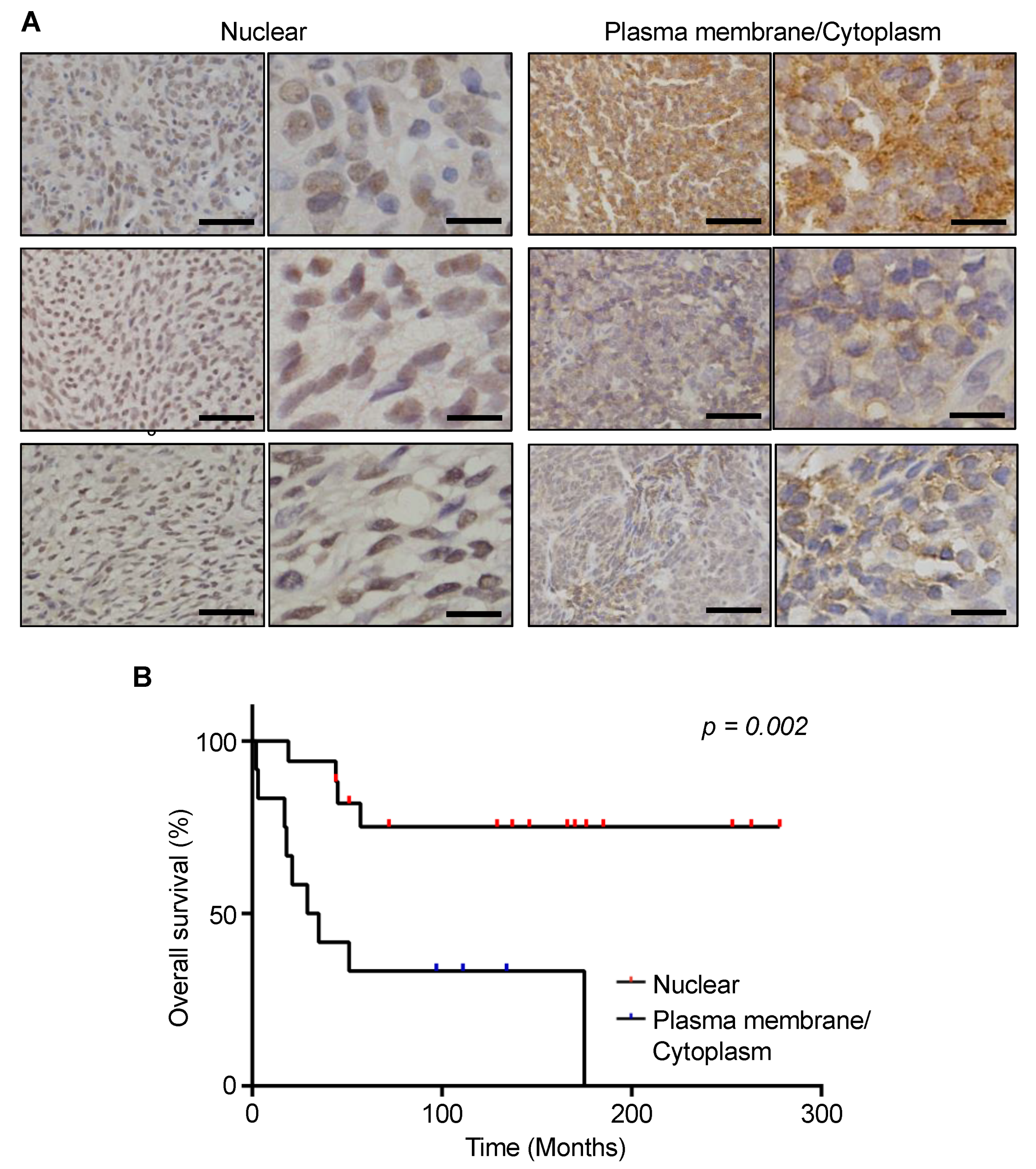 Cancers 13 01823 g004 Cancers 13 01823 g004