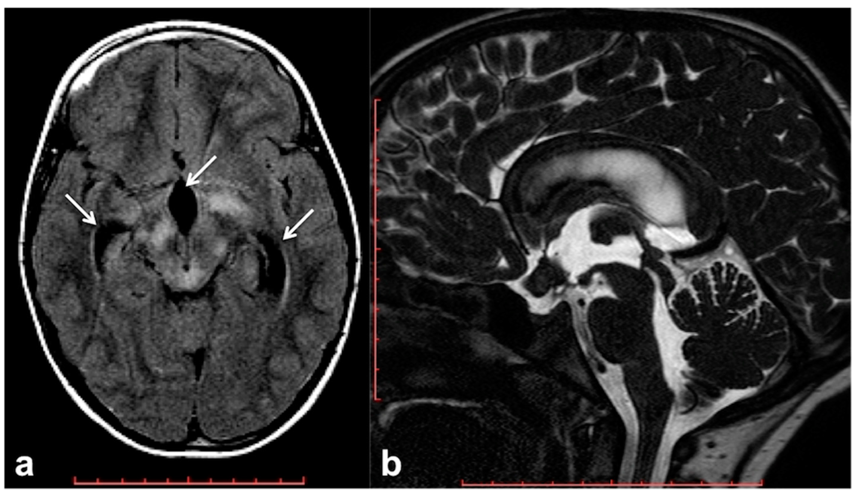 Cancers 13 01831 g003 Cancers 13 01831 g003
