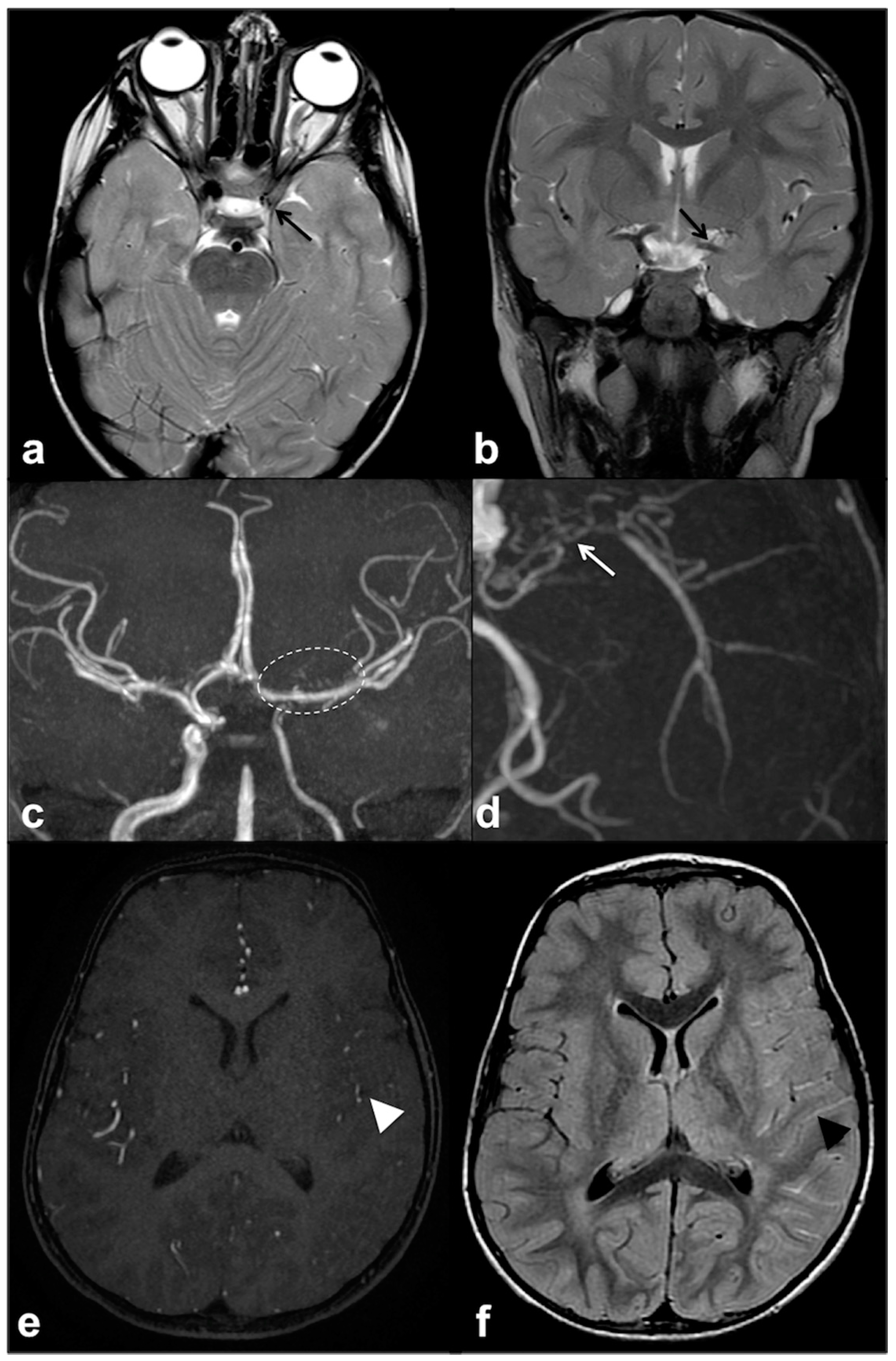 Cancers 13 01831 g005 Cancers 13 01831 g005