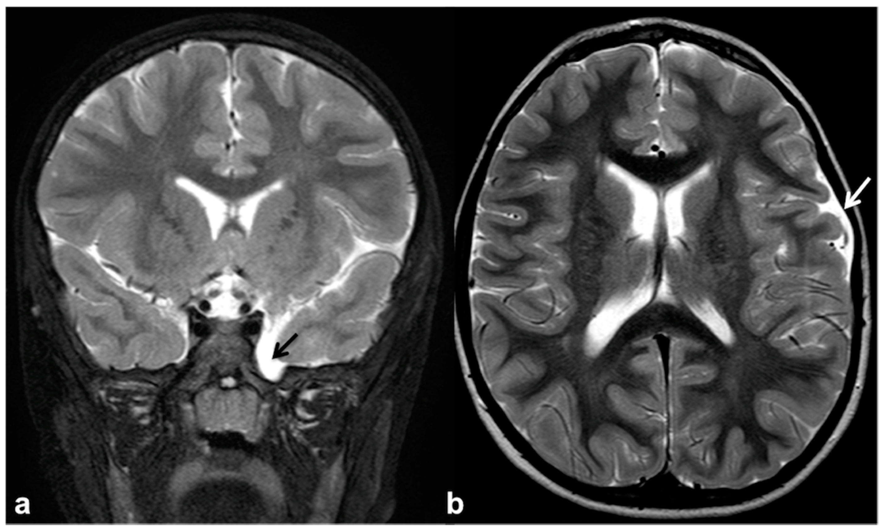 Cancers 13 01831 g006 Cancers 13 01831 g006