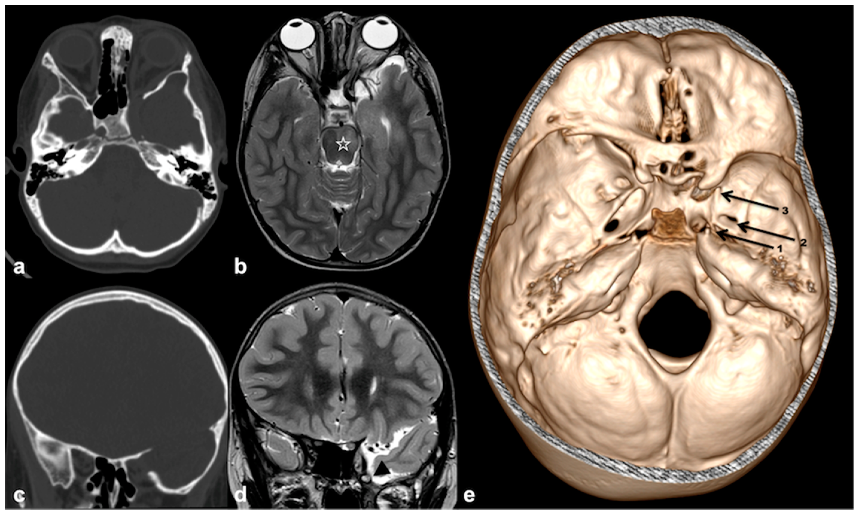 Cancers 13 01831 g007 Cancers 13 01831 g007
