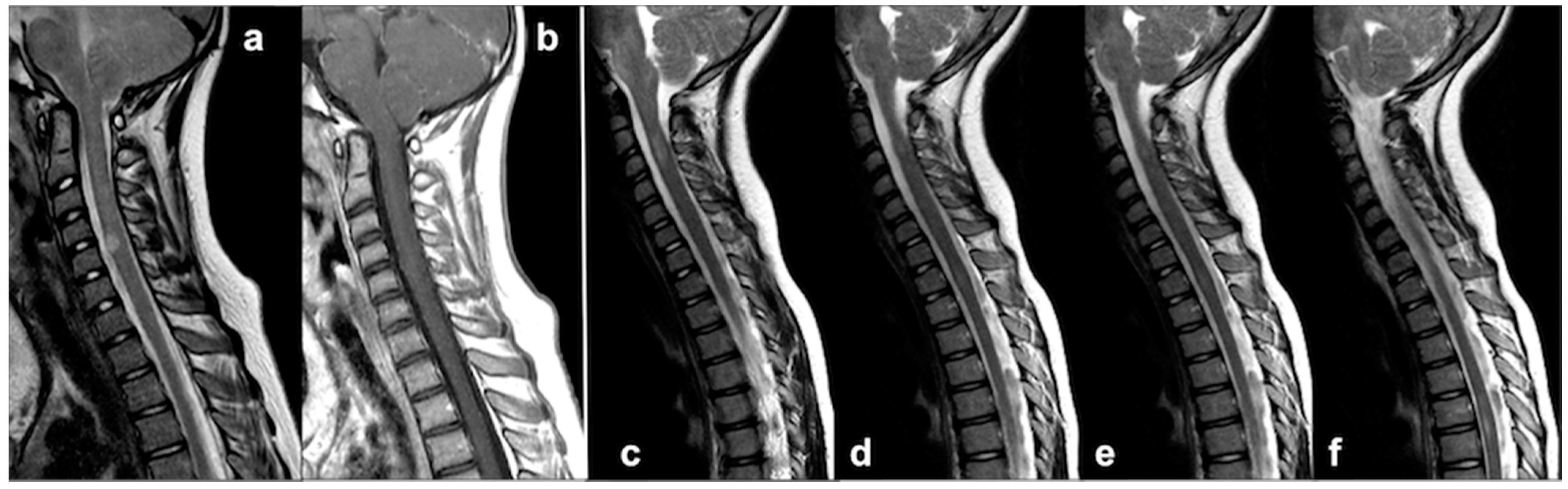 Cancers 13 01831 g008 Cancers 13 01831 g008
