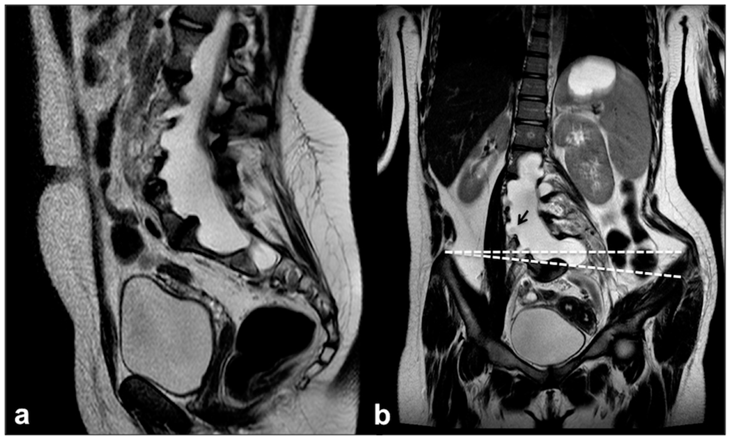 Cancers 13 01831 g009 Cancers 13 01831 g009