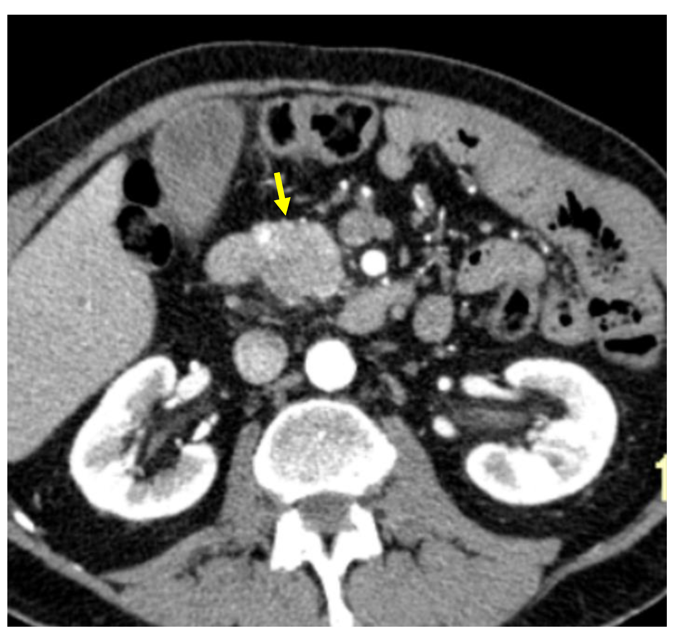 Cancers 13 01843 g002