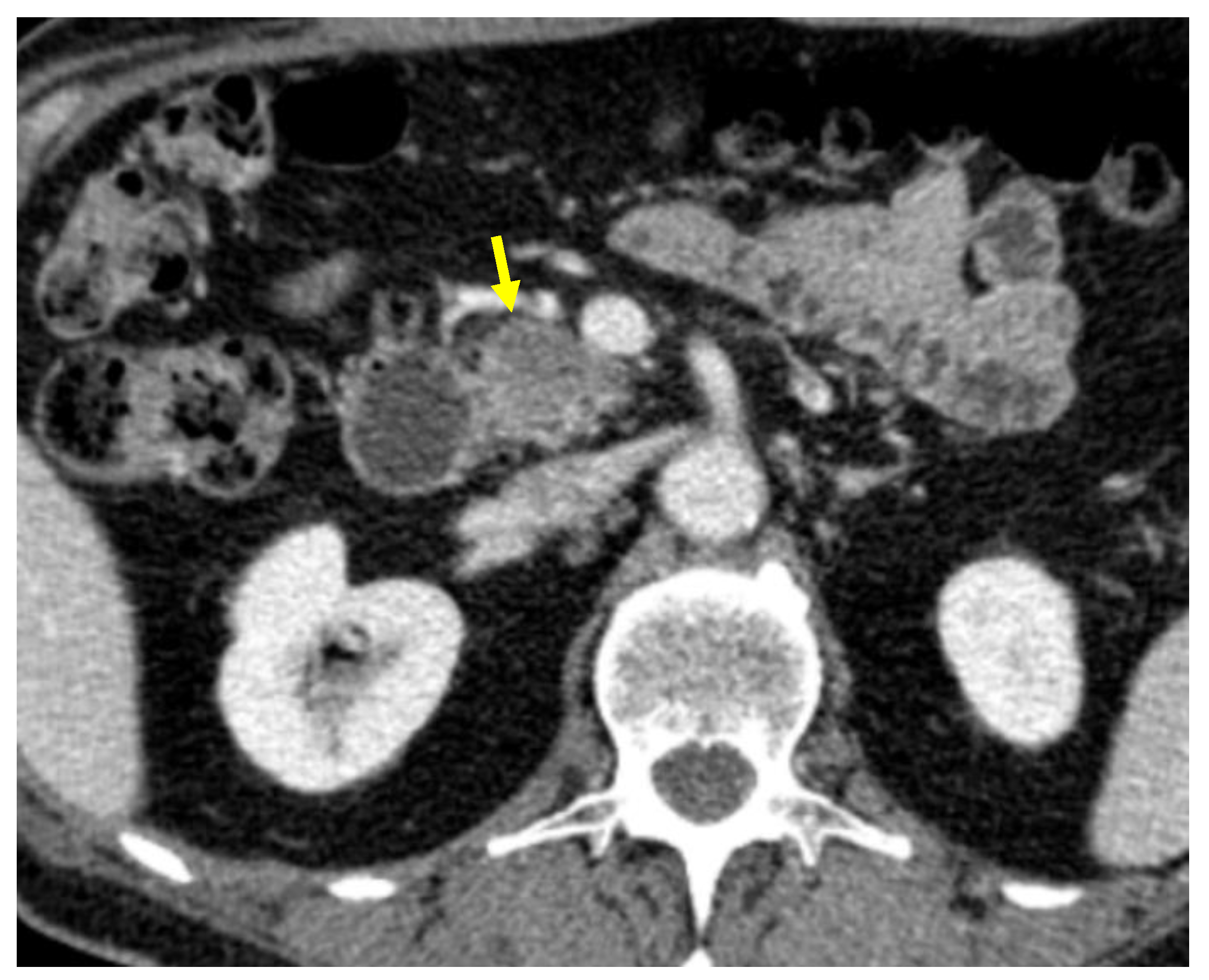 Cancers 13 01843 g003