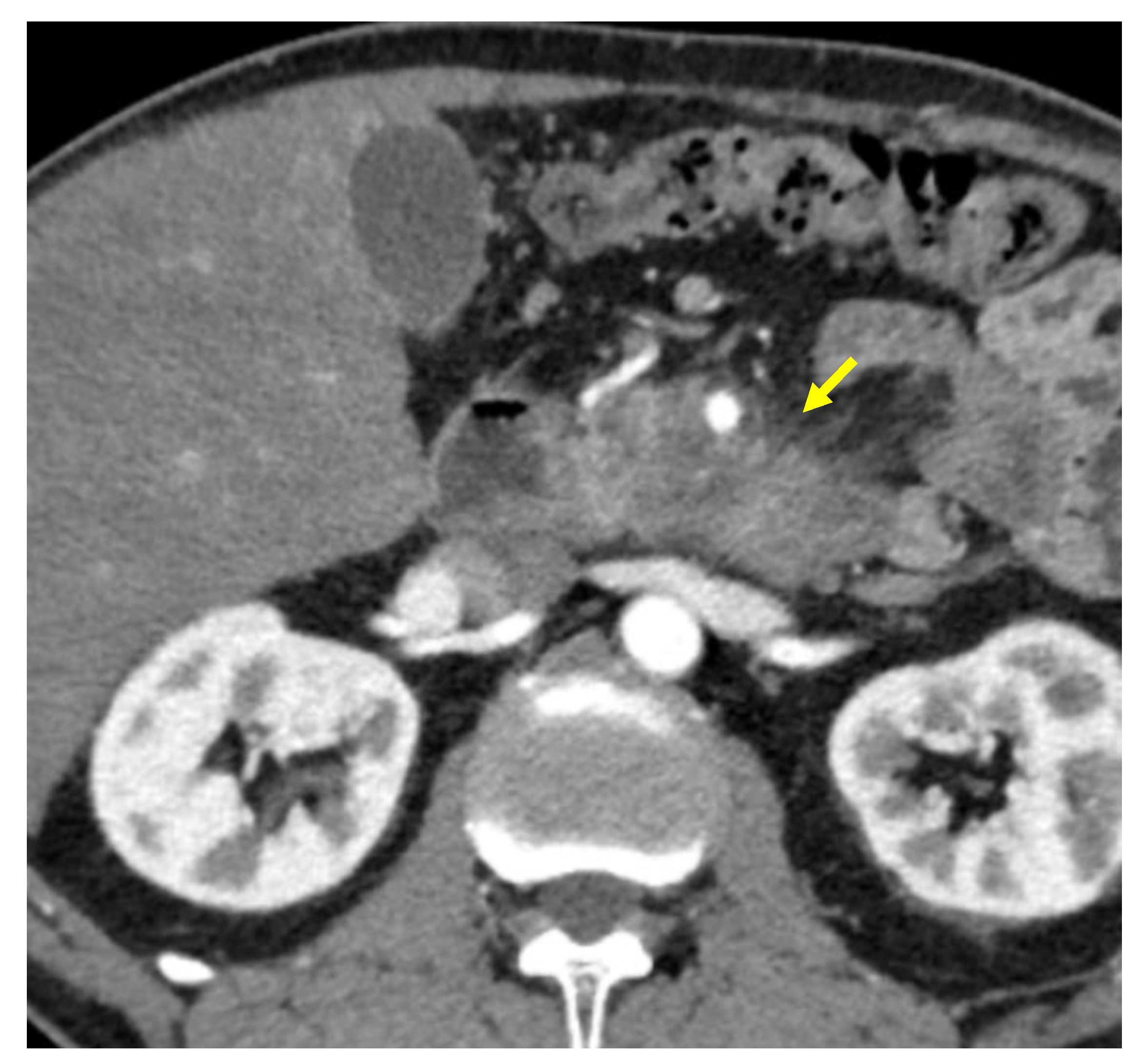 Cancers 13 01843 g004