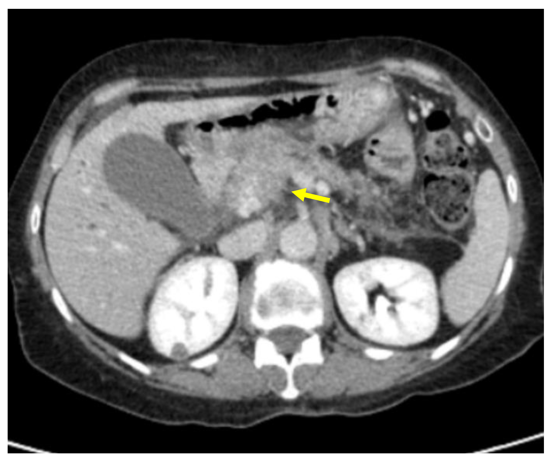 Cancers 13 01843 g005