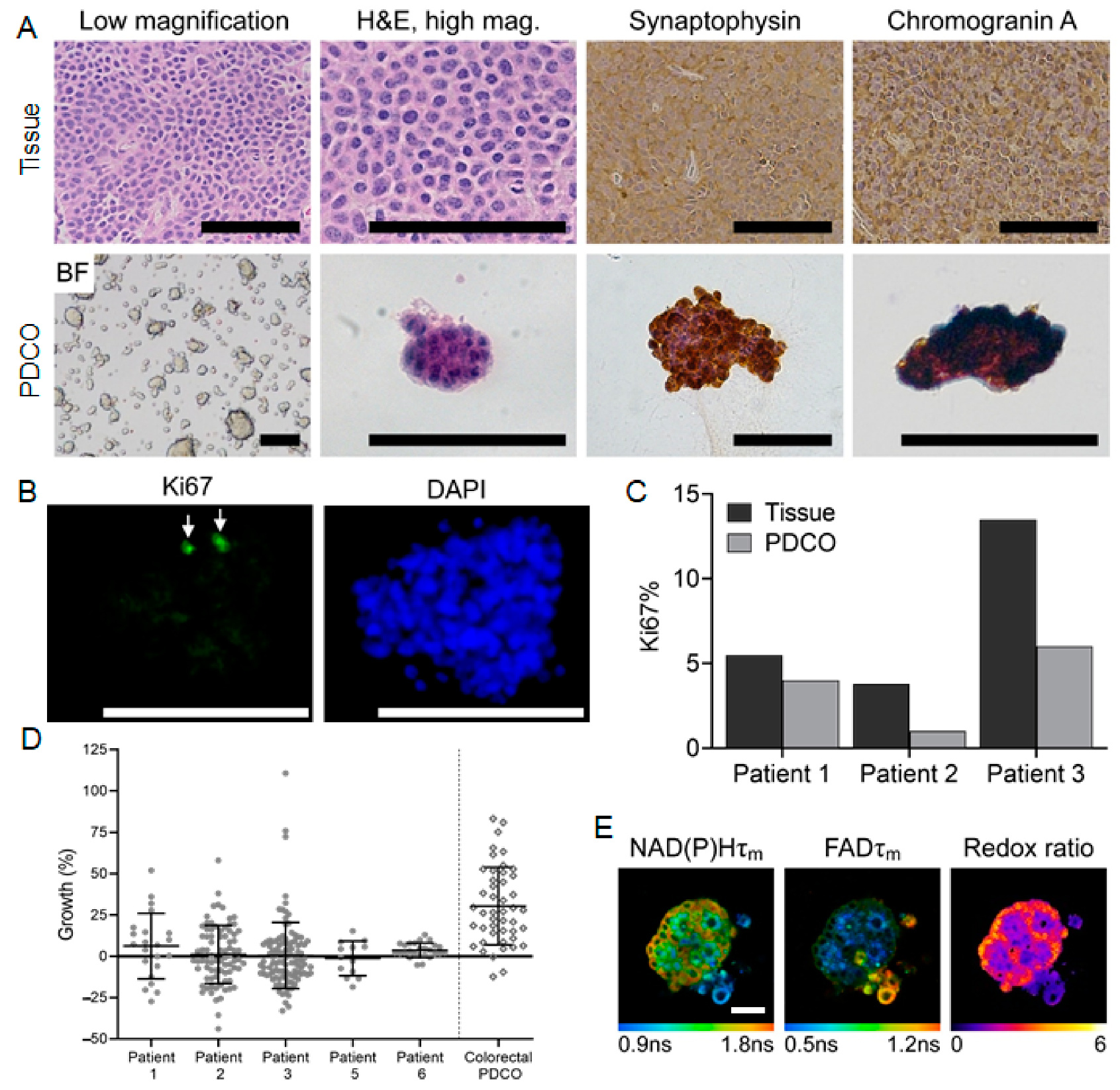 Cancers 13 01873 g003 Cancers 13 01873 g003