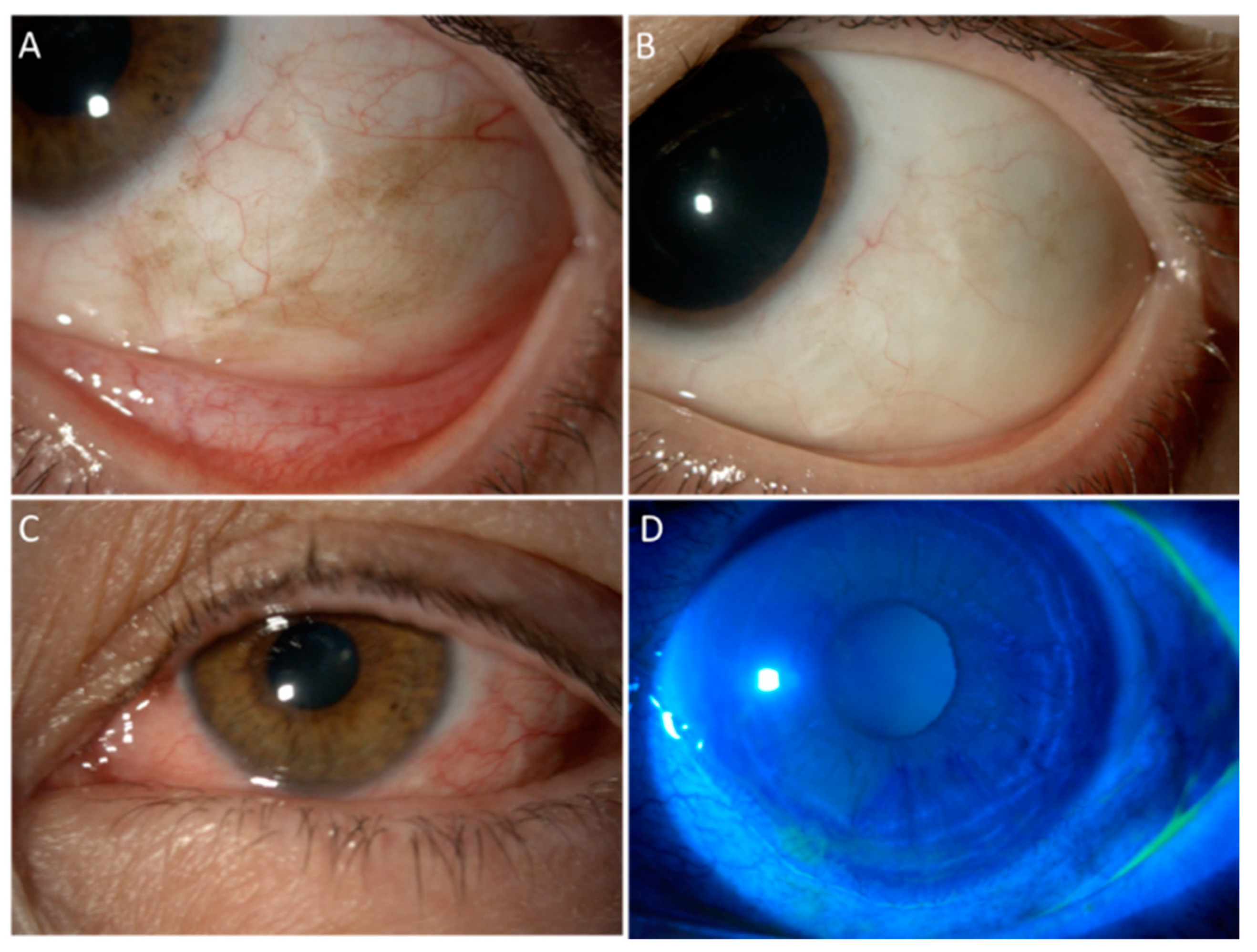 Cancers 13 01933 g001 Cancers 13 01933 g001