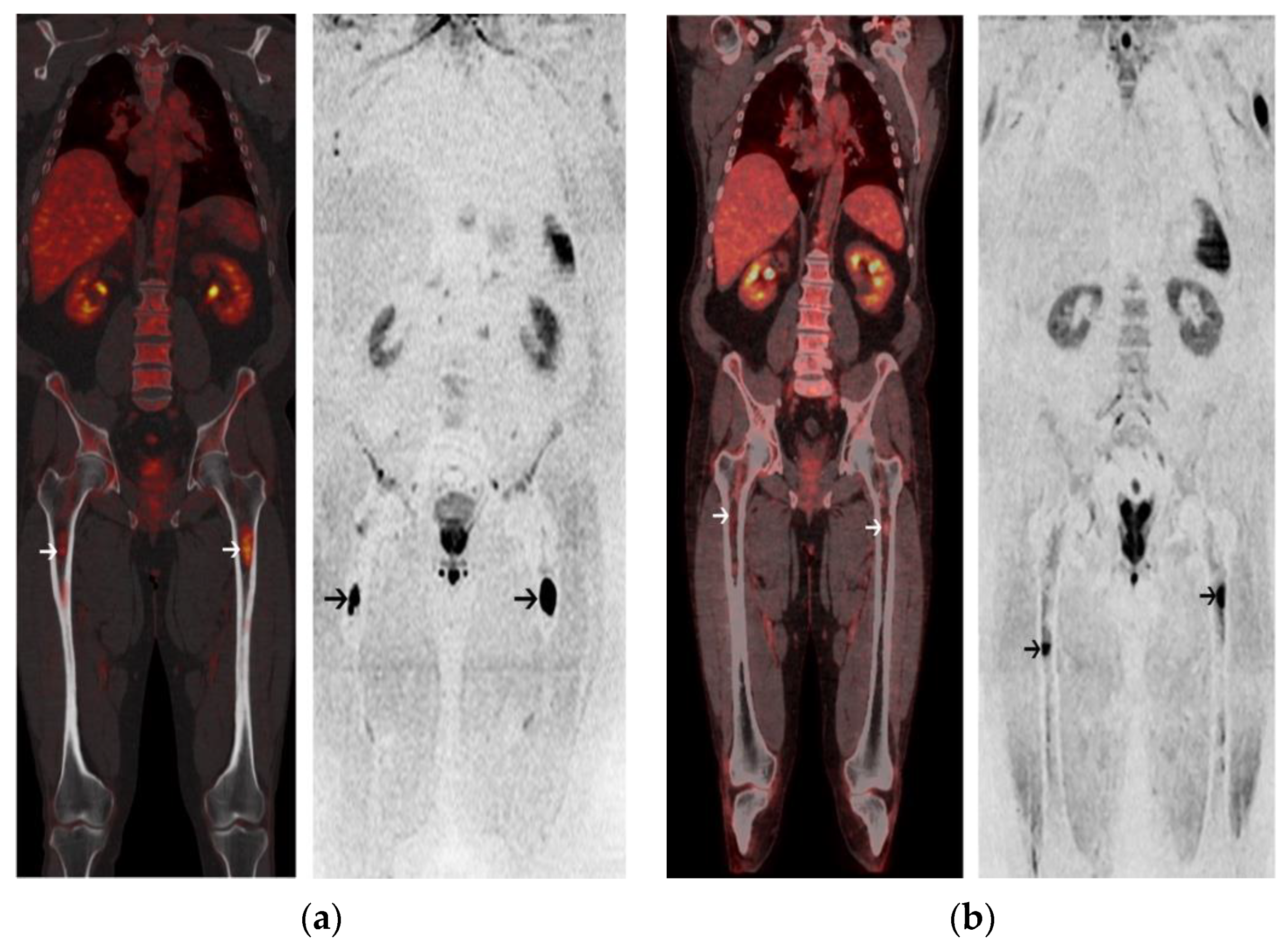 Cancers 13 01938 g005