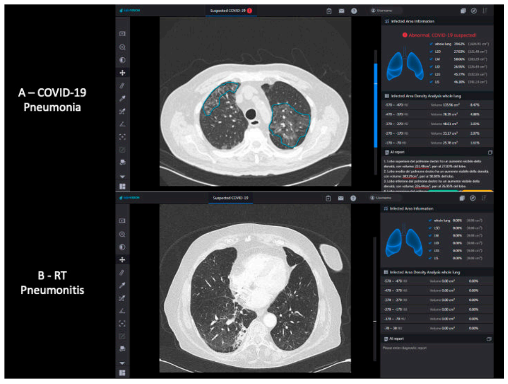 Cancers 13 01960 g001