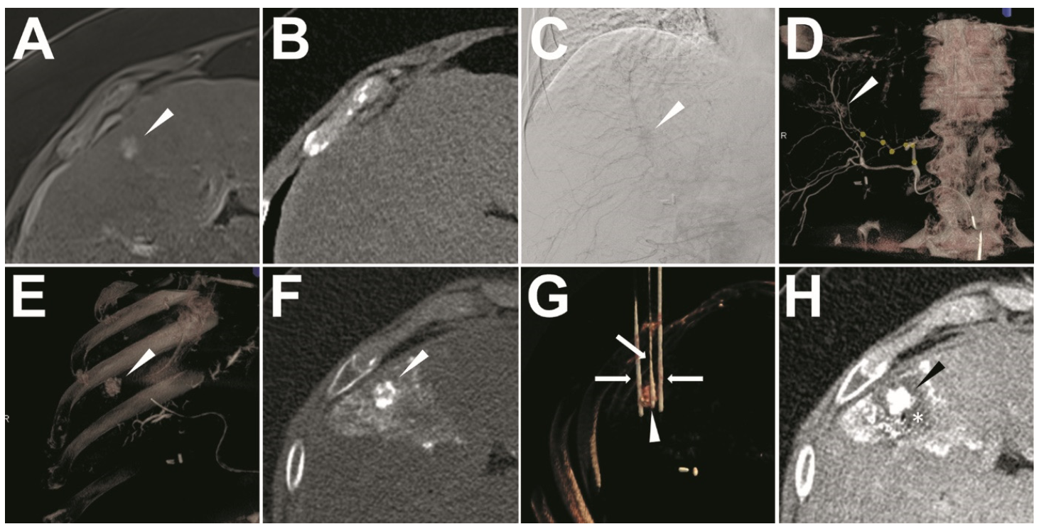Cancers 13 02021 g001 Cancers 13 02021 g001