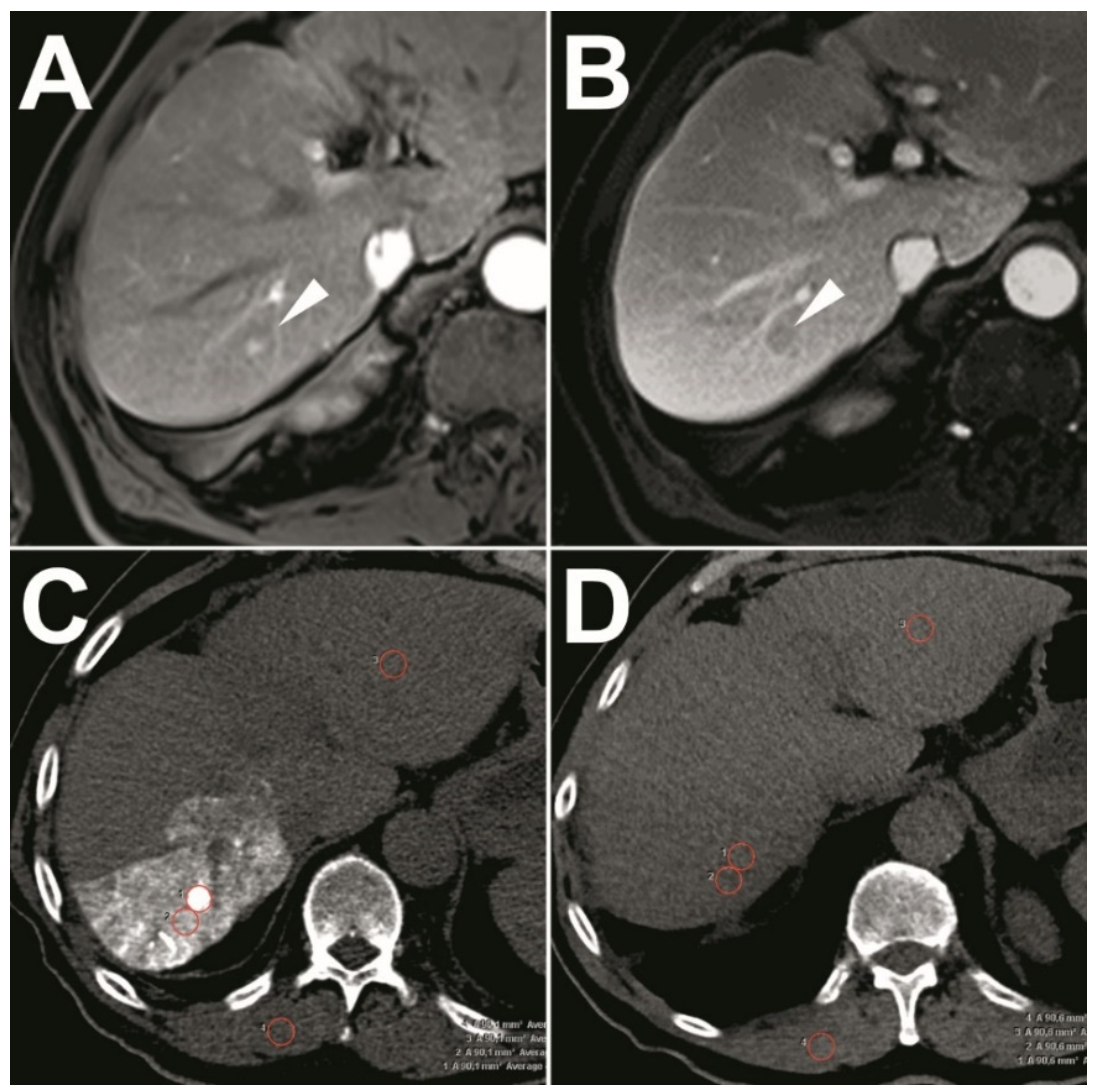 Cancers 13 02021 g002 Cancers 13 02021 g002