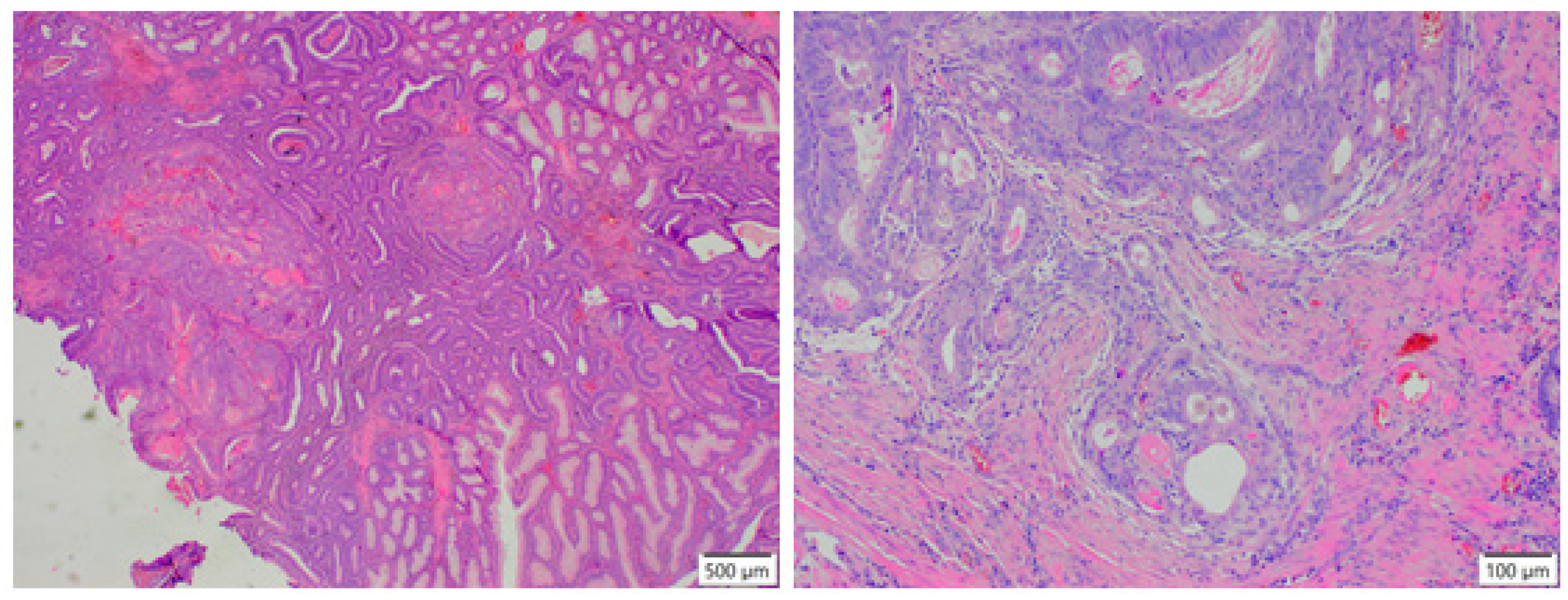 Cancers 13 02025 g005 Cancers 13 02025 g005