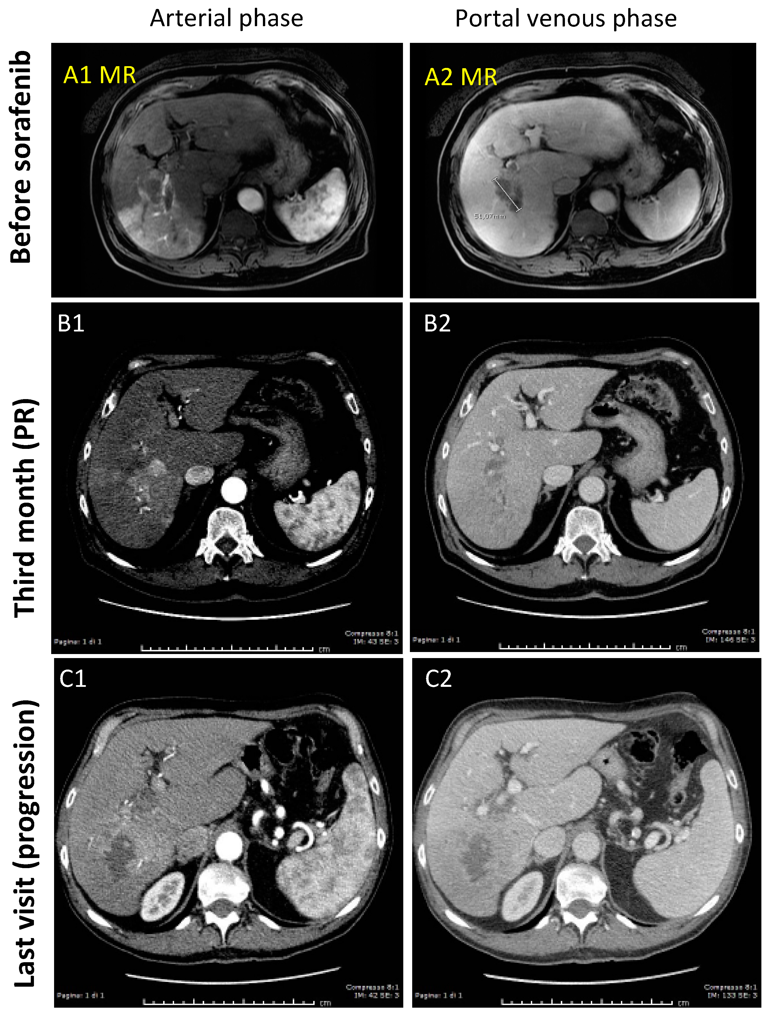 Cancers 13 02064 g003 Cancers 13 02064 g003