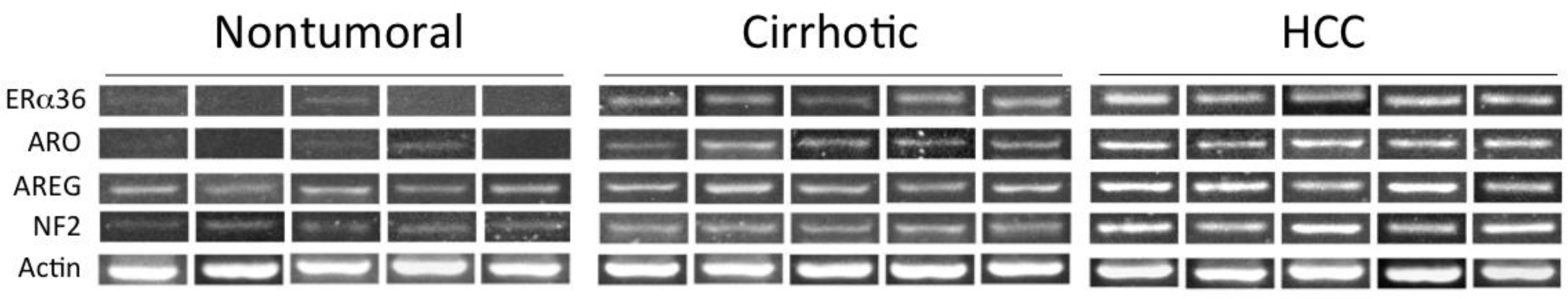 Cancers 13 02085 g006 Cancers 13 02085 g006