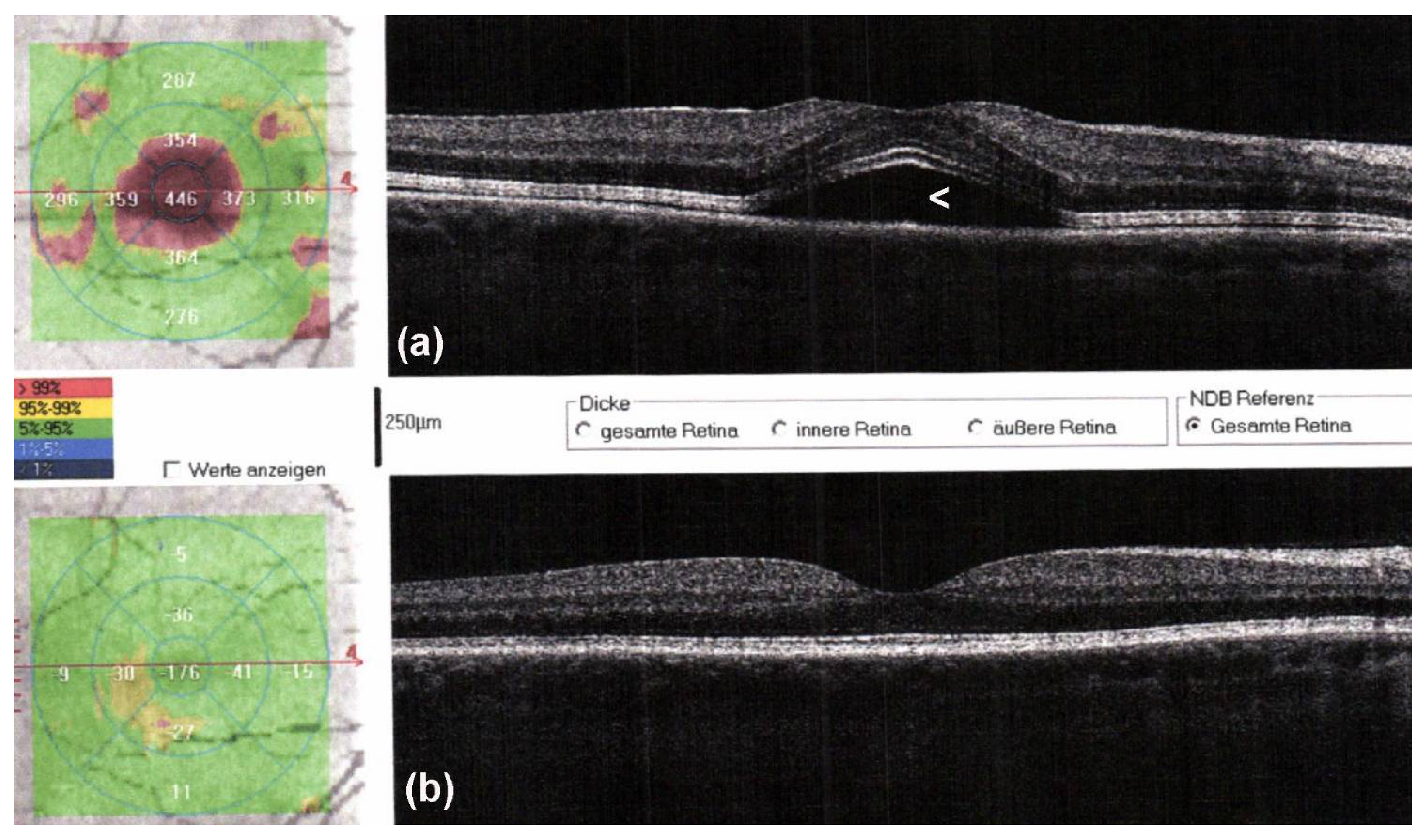 Cancers 13 02090 g005 Cancers 13 02090 g005