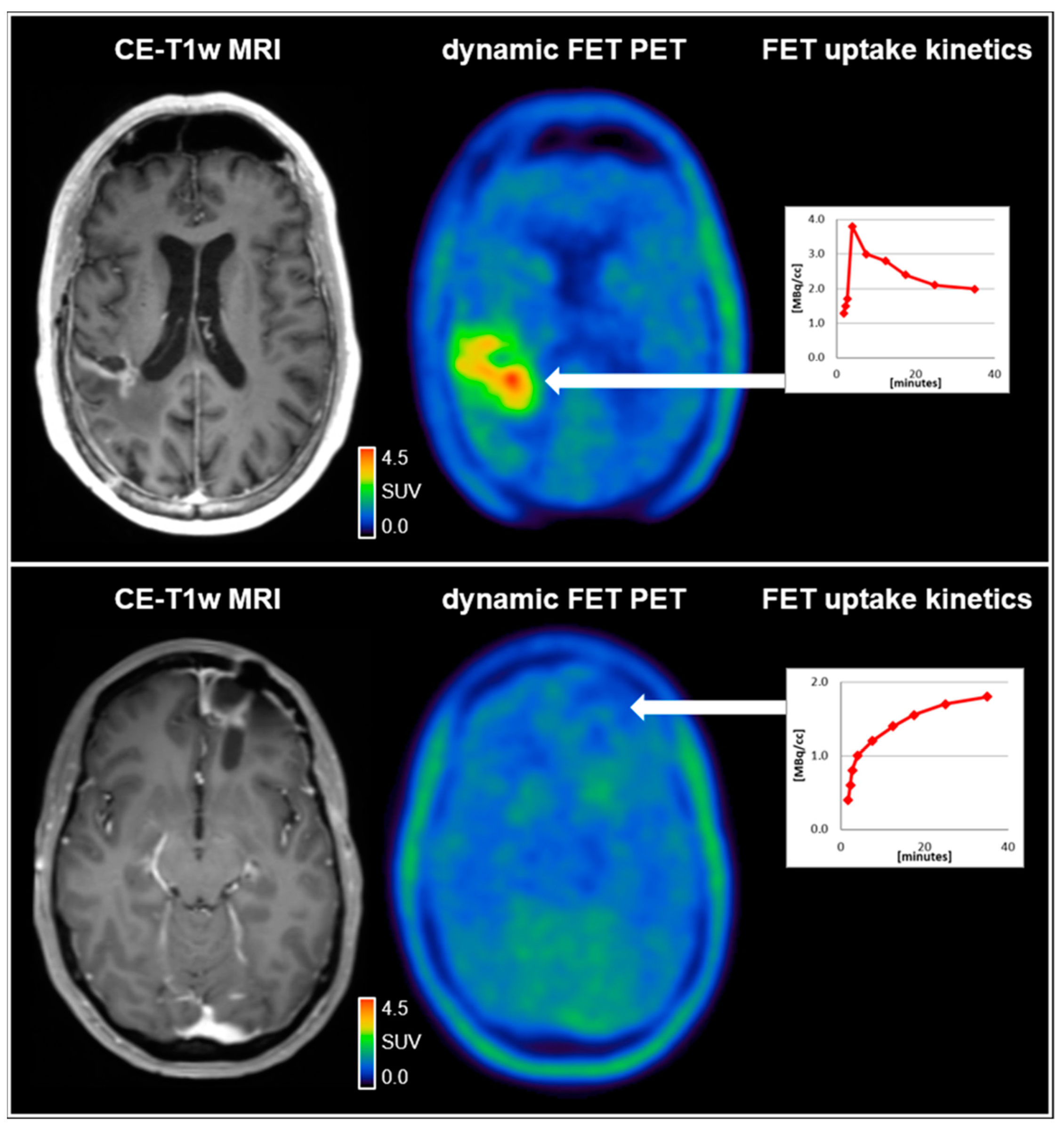 Cancers | Free Full-Text | Use of PET Imaging in Neuro-Oncological ...