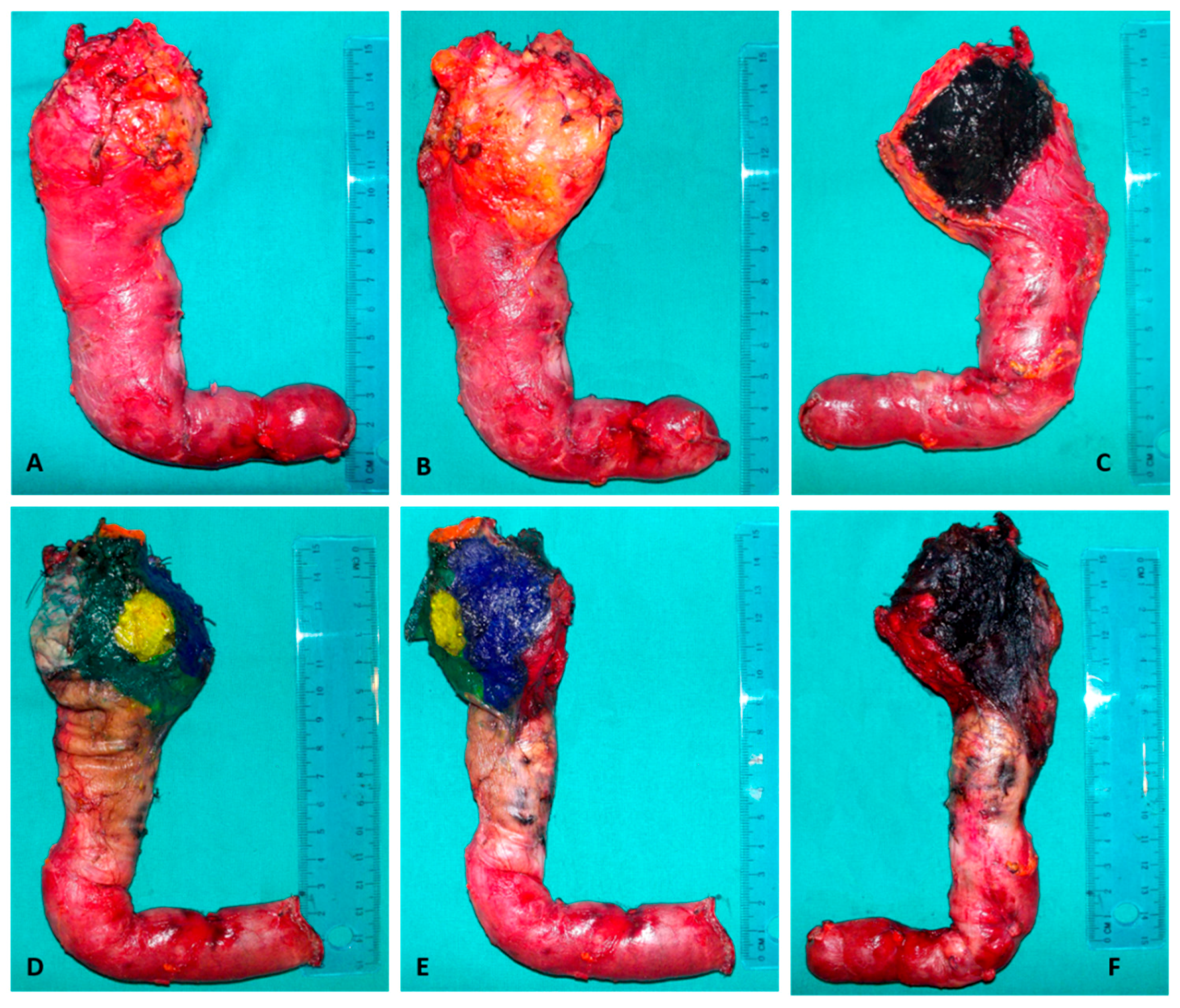 Cancers 13 02097 g002 Cancers 13 02097 g002