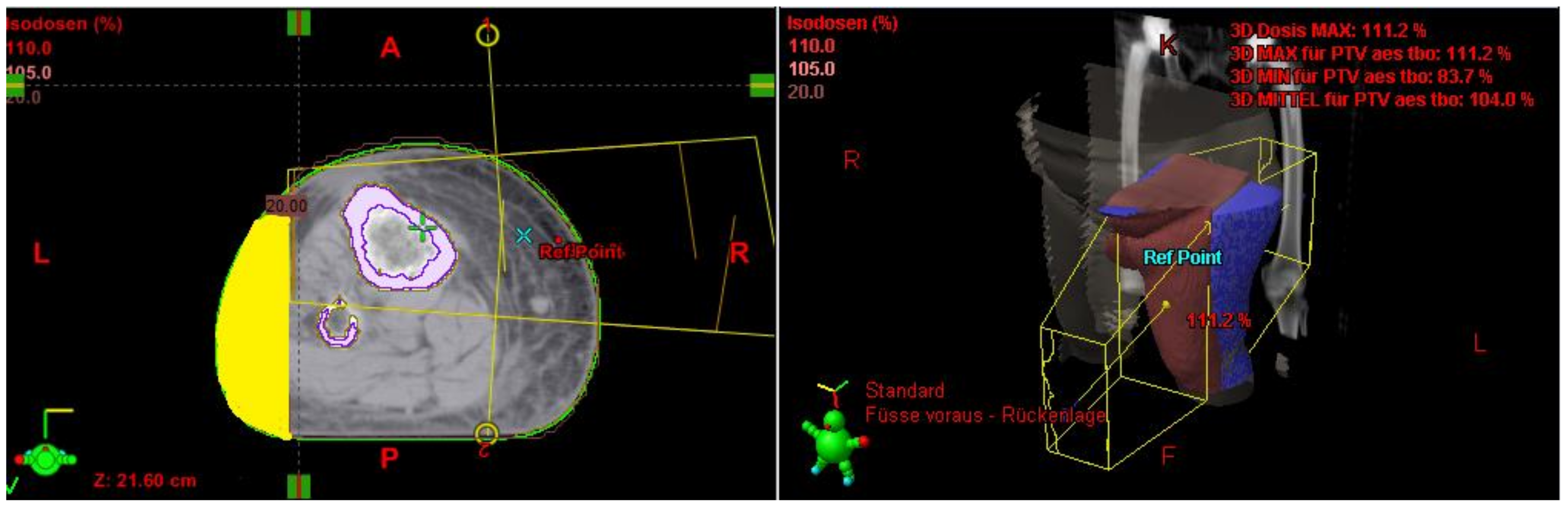Cancers 13 02113 g001