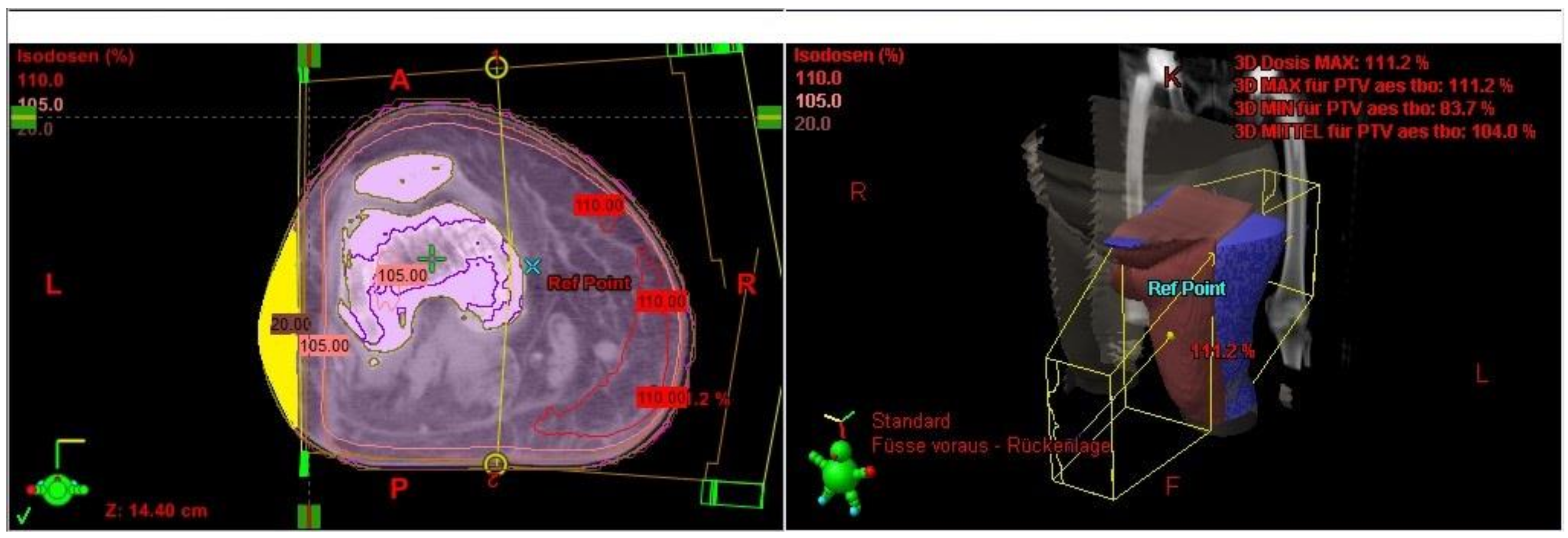 Cancers 13 02113 g002