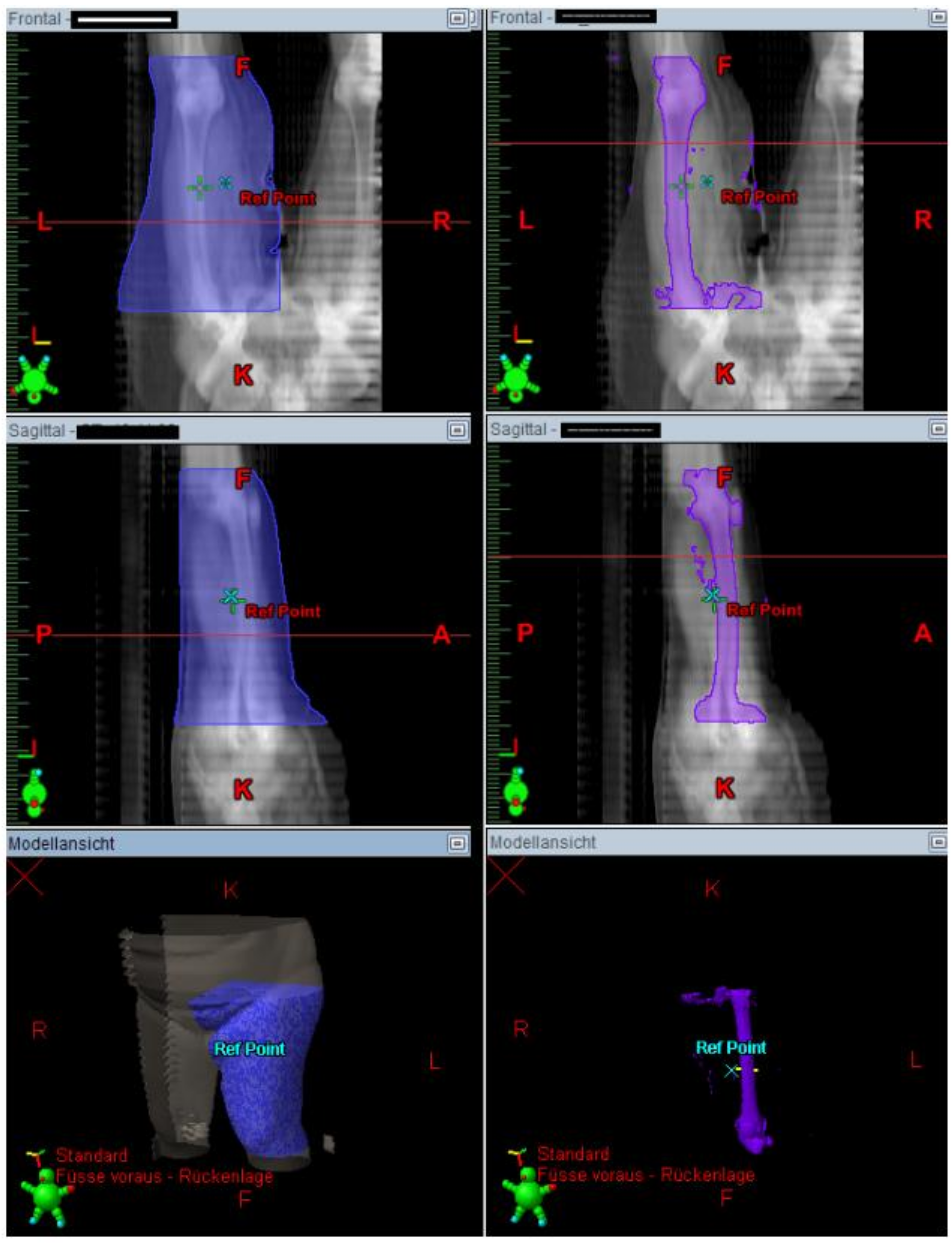Cancers 13 02113 g003