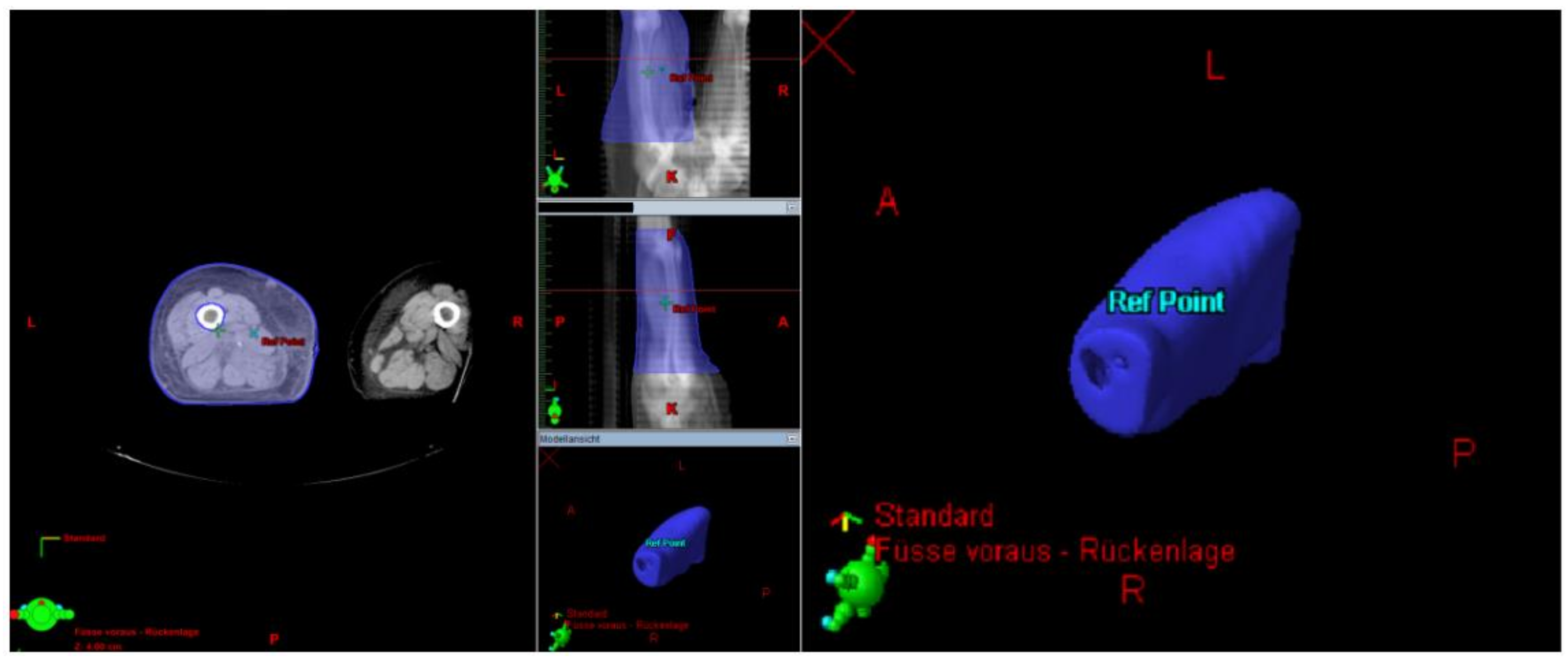 Cancers 13 02113 g004