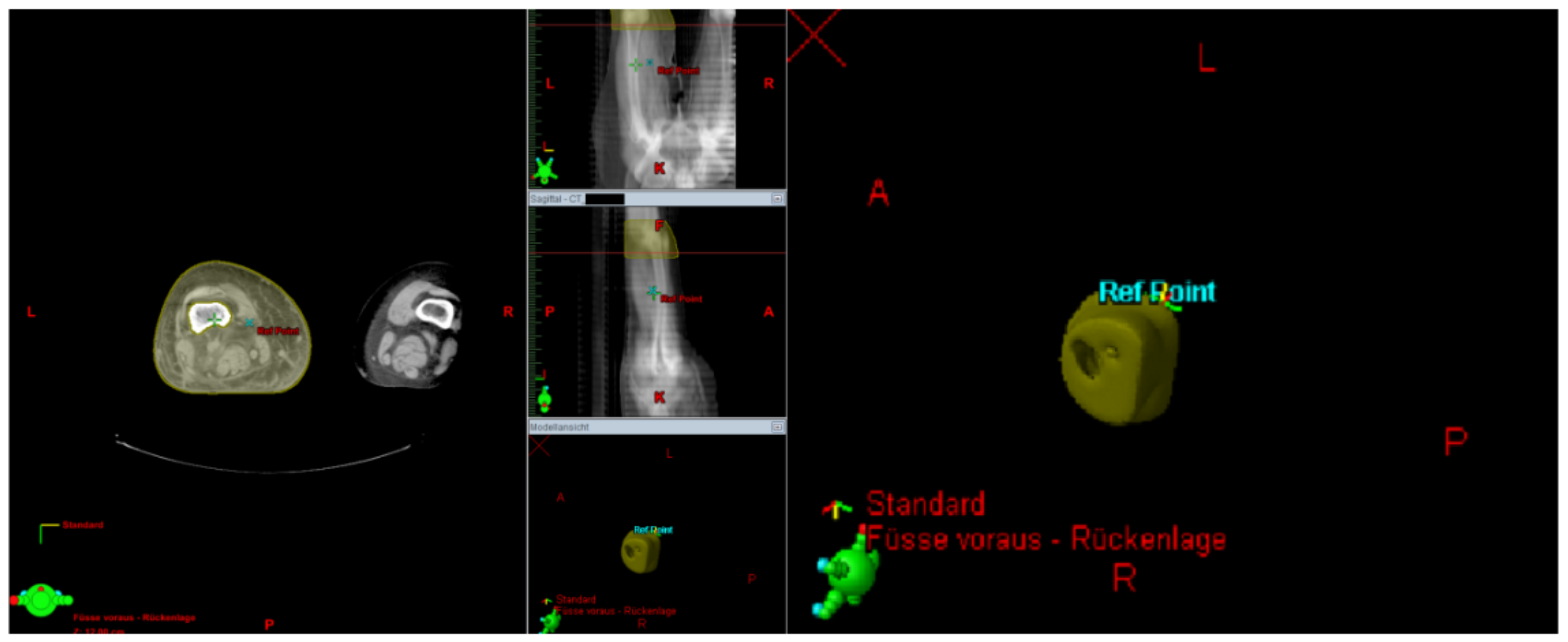 Cancers 13 02113 g005
