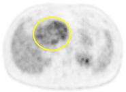 Cancers 13 02119 i006