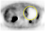 Cancers 13 02119 i008