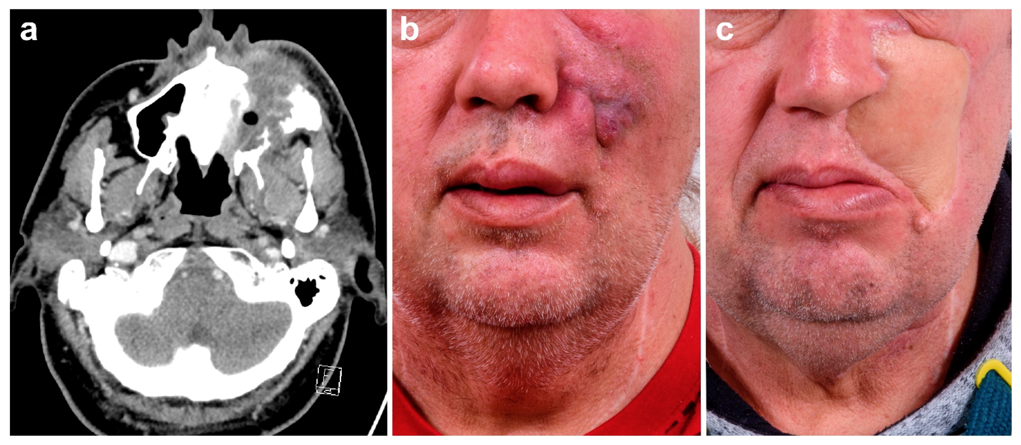 Cancers 13 02122 g003