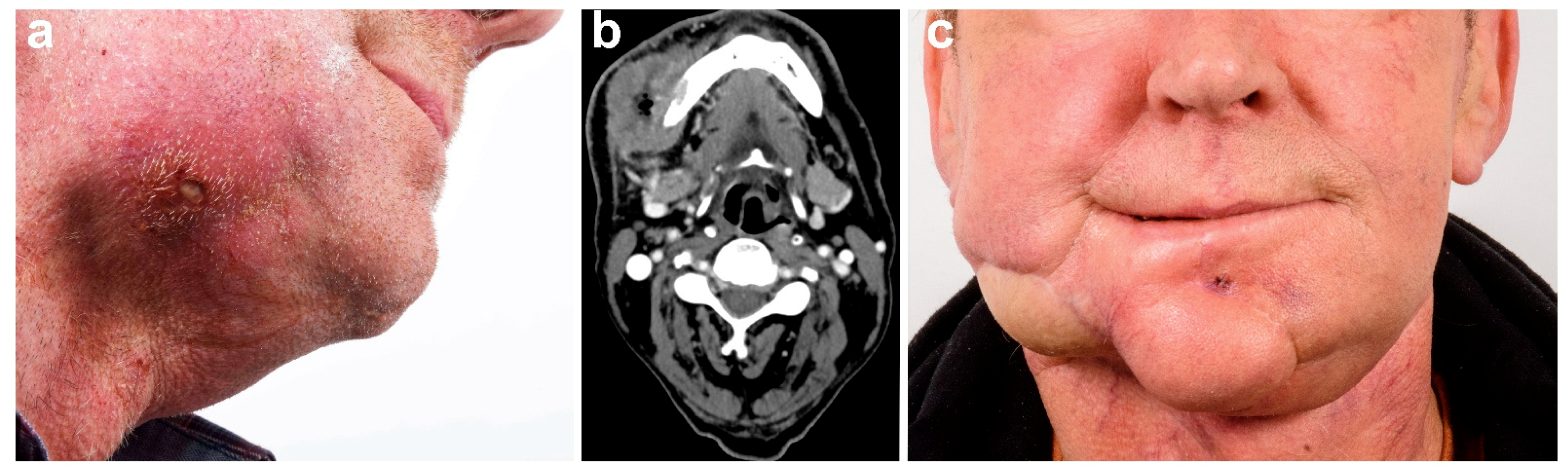 Cancers 13 02122 g004