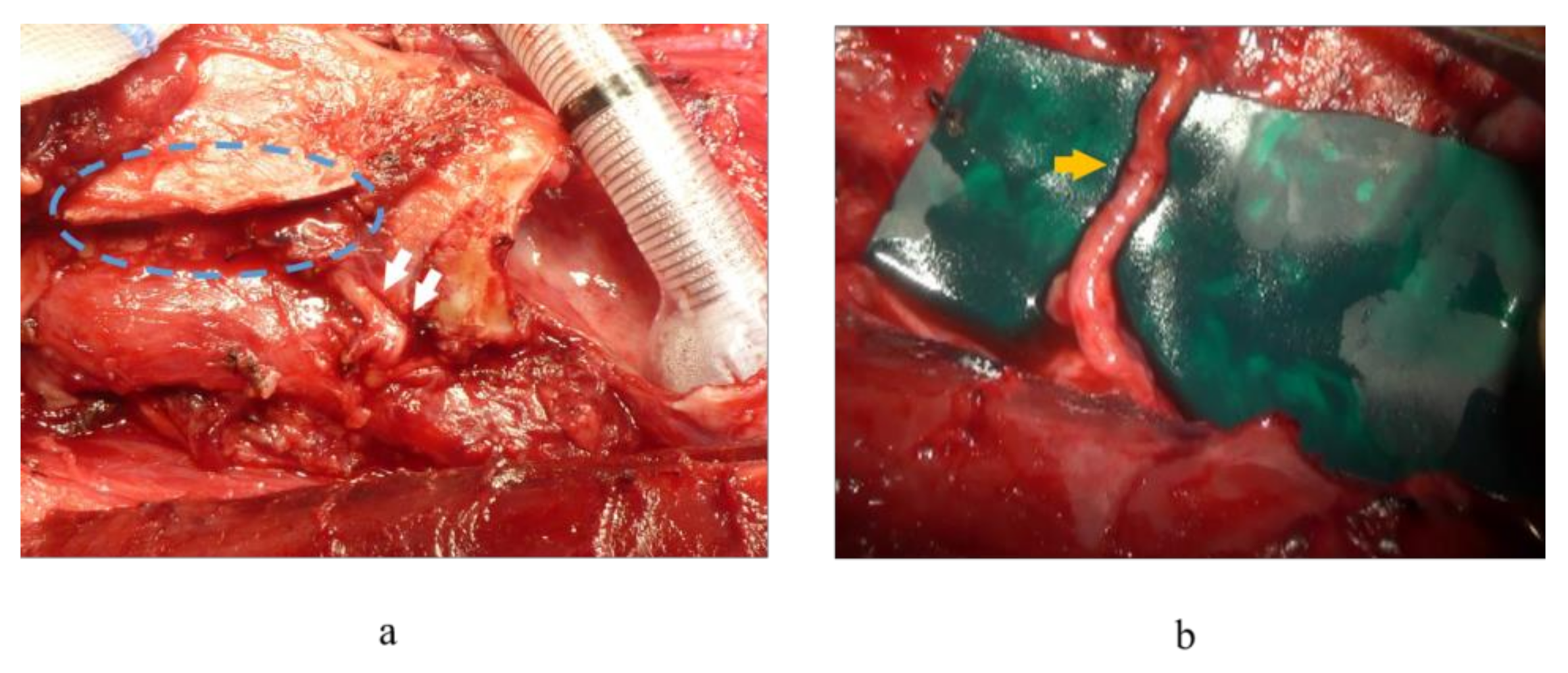 Cancers 13 02129 g001