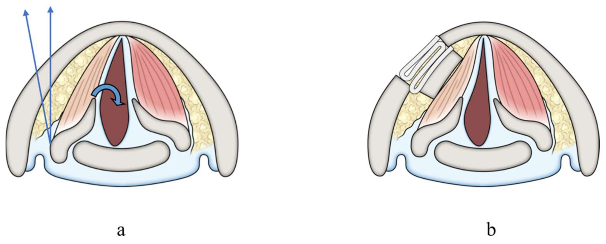 Cancers 13 02129 g004