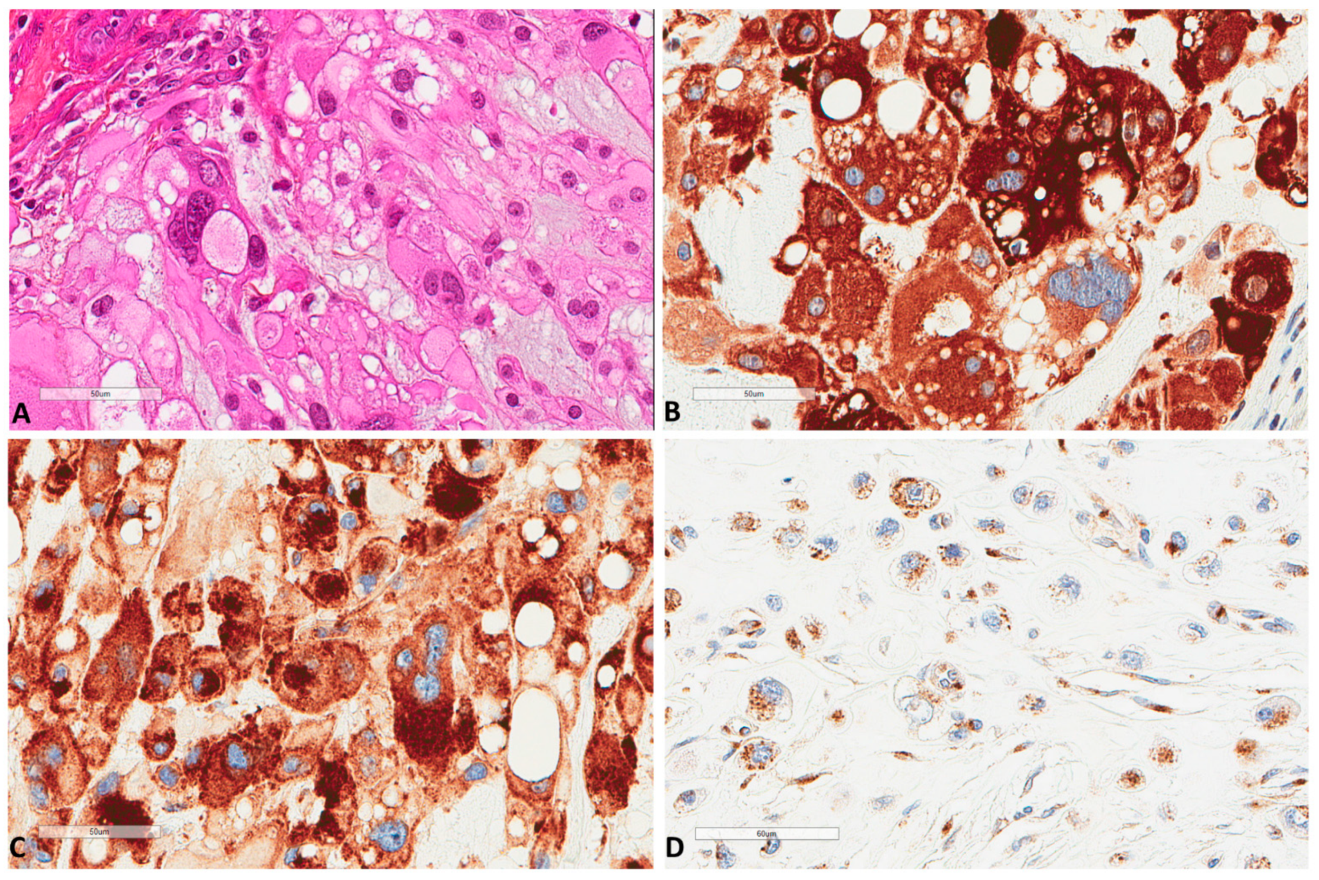 Cancers 13 02169 g002 Cancers 13 02169 g002