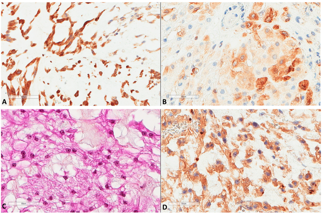 Cancers 13 02169 g003 Cancers 13 02169 g003