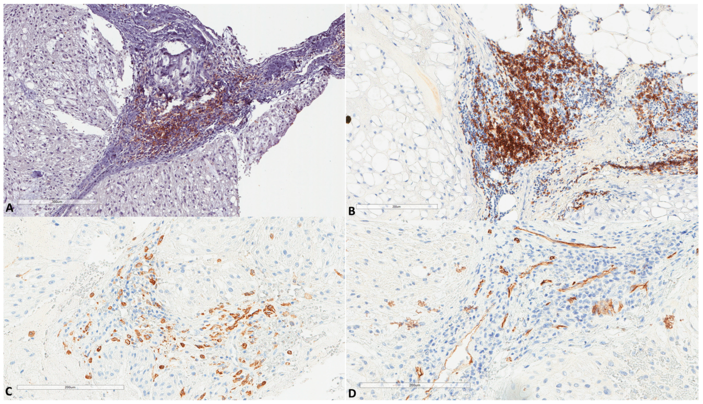 Cancers 13 02169 g005 Cancers 13 02169 g005