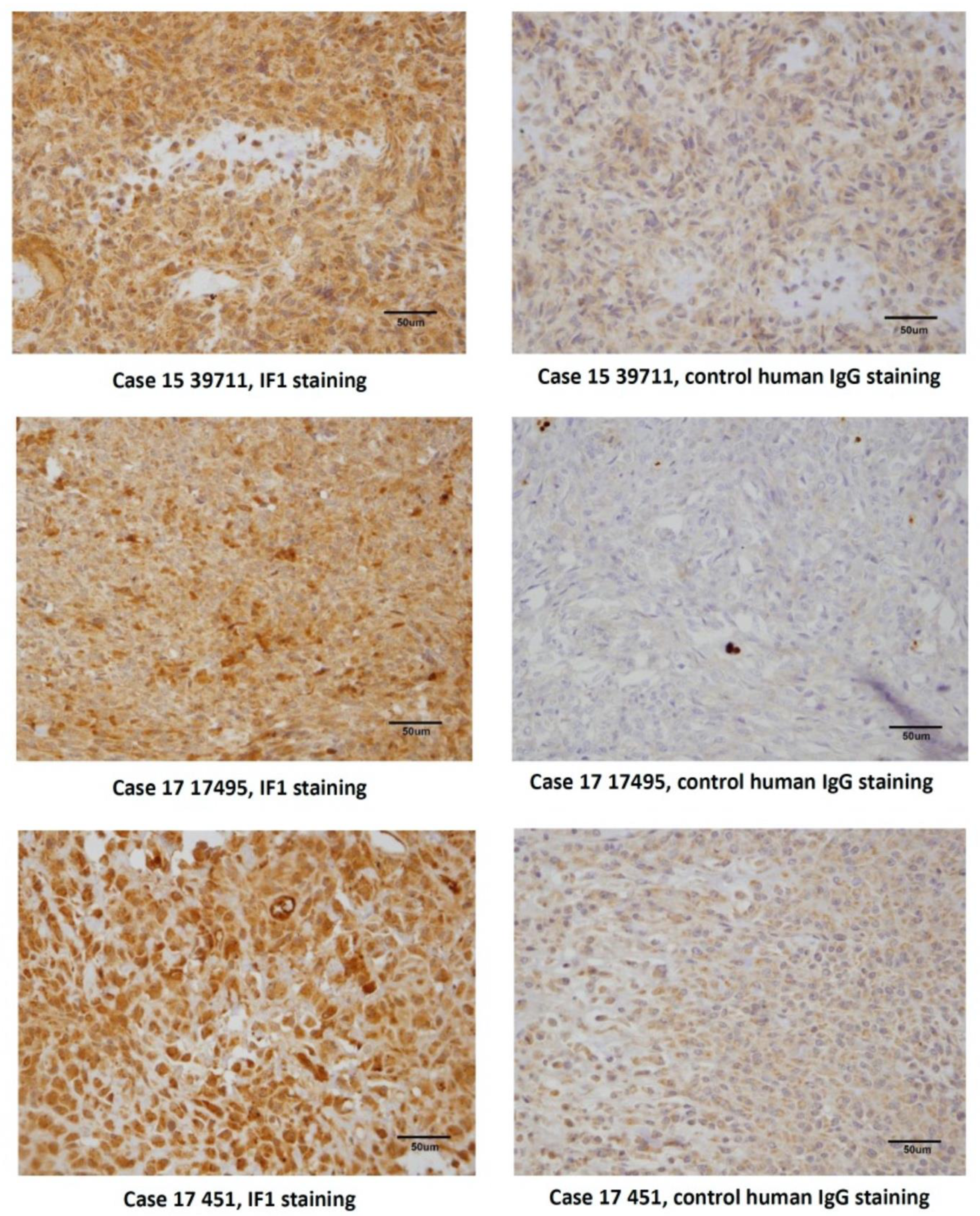 Cancers 13 02208 g006