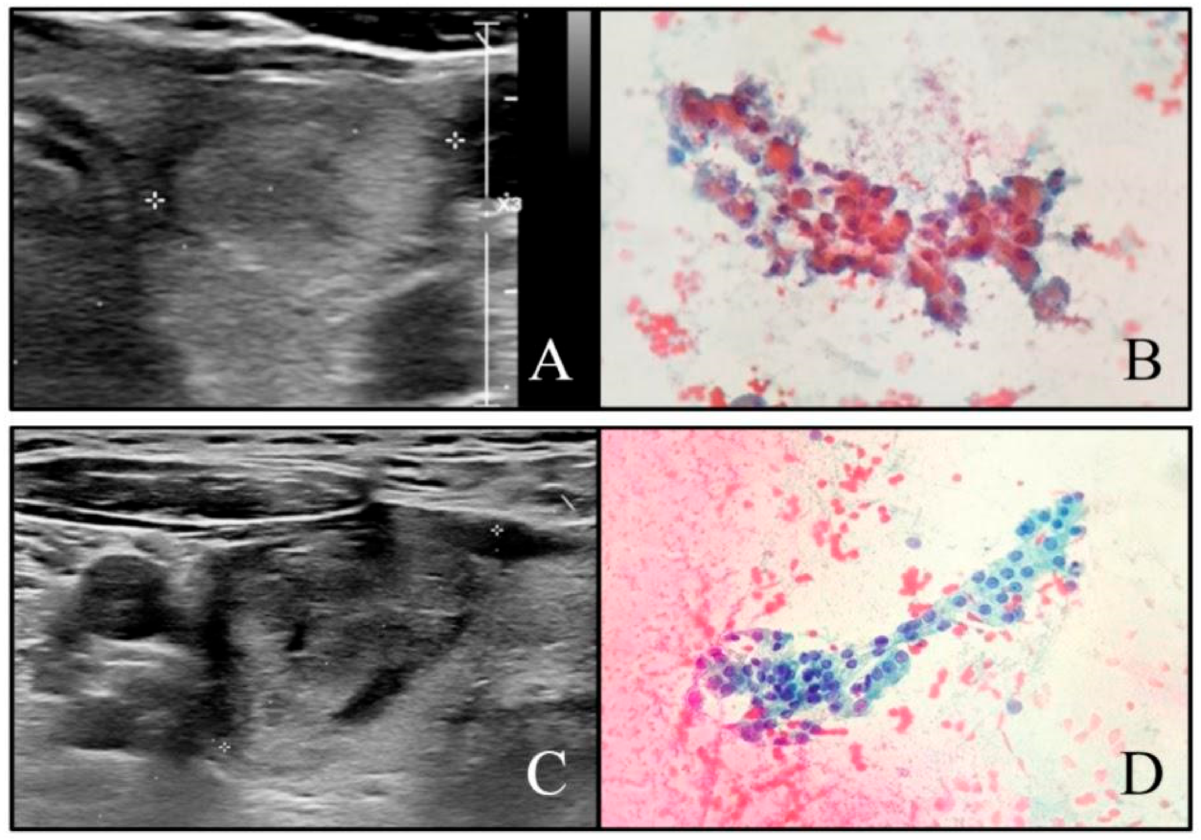 Cancers 13 02230 g003 Cancers 13 02230 g003