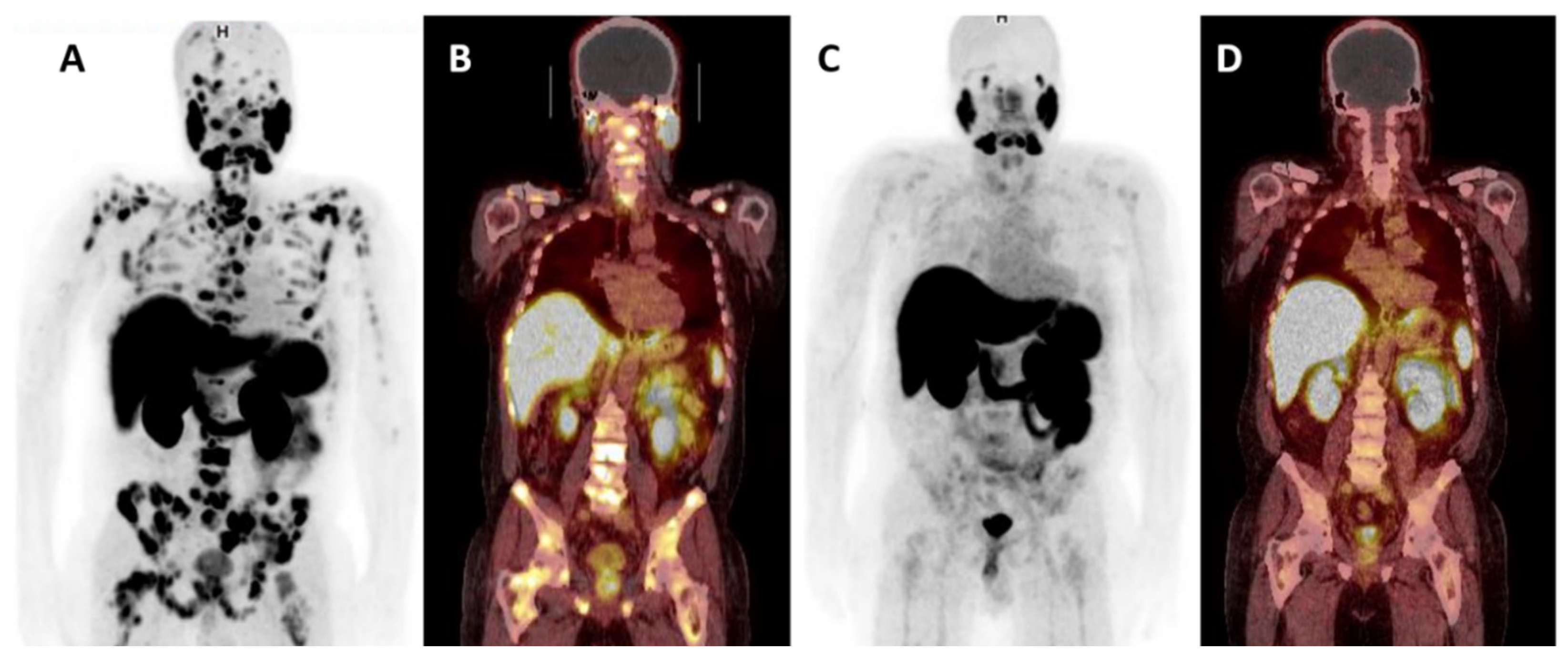 Cancers 13 02244 g004 Cancers 13 02244 g004