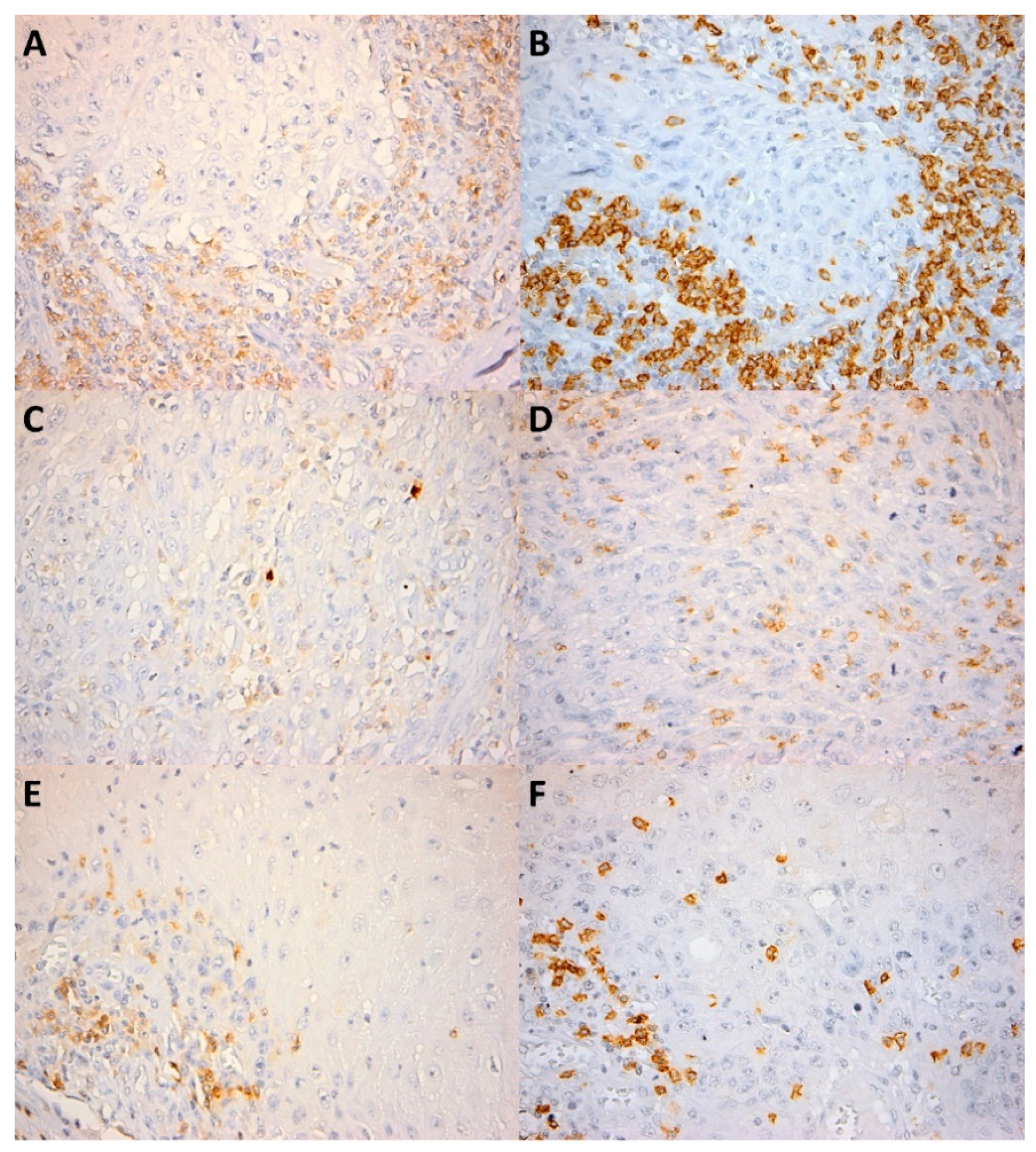 Cancers 13 02268 g001 Cancers 13 02268 g001