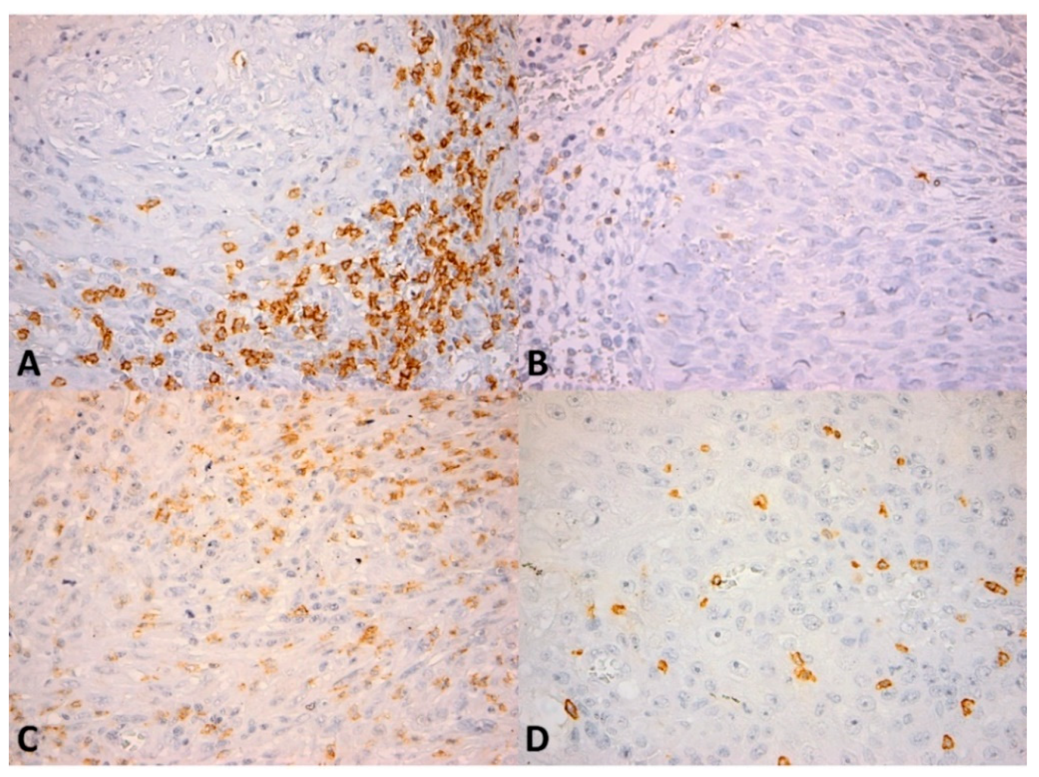 Cancers 13 02268 g002 Cancers 13 02268 g002