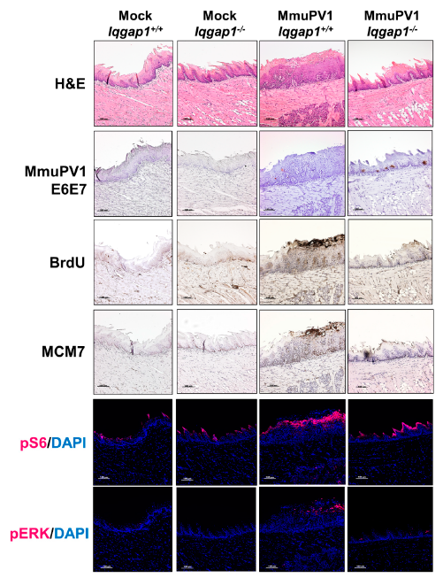 Cancers 13 02276 g004