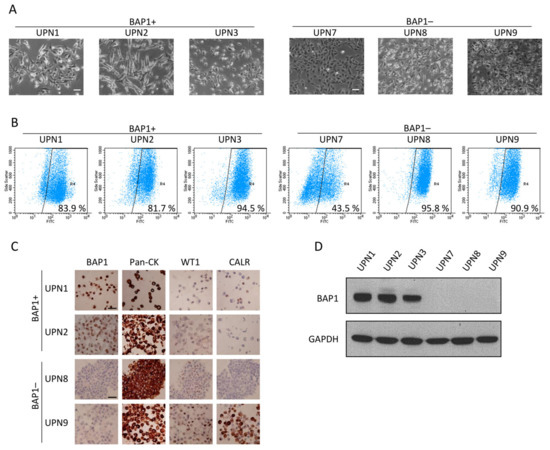 where is sarcoma cancer found